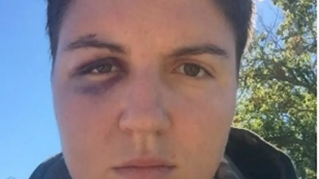 A Lesbian Professor Claims She Was Beaten At A Toby Keith Concert. Then The Real Story Emerges.