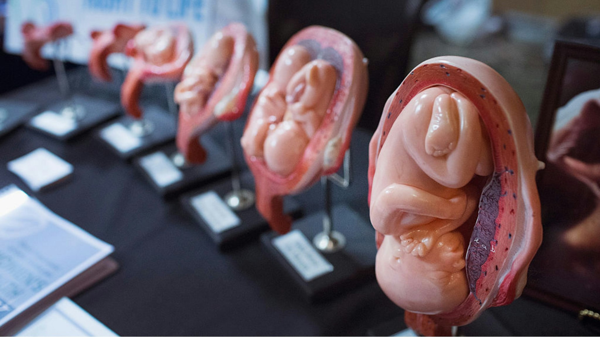 Stages of a fetus are displayed at the Illinois Right To Life a table while Republican presidential hopeful and former Arkansas Governor Mike Huckabee speaks at the Freedom's Journal Institute for the Study of Faith and Public Policy 2015 Rise Initiative on July 31, 2015 in Tinley Park, Illinois.