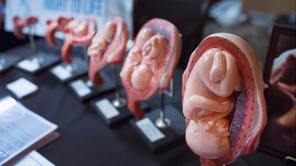 Fetuses. Stages of a fetus are displayed at the Illinois Right To Life a table while Republican presidential hopeful and former Arkansas Governor Mike Huckabee speaks at the Freedom's Journal Institute for the Study of Faith and Public Policy 2015 Rise Initiative on July 31, 2015 in Tinley Park, Illinois.
