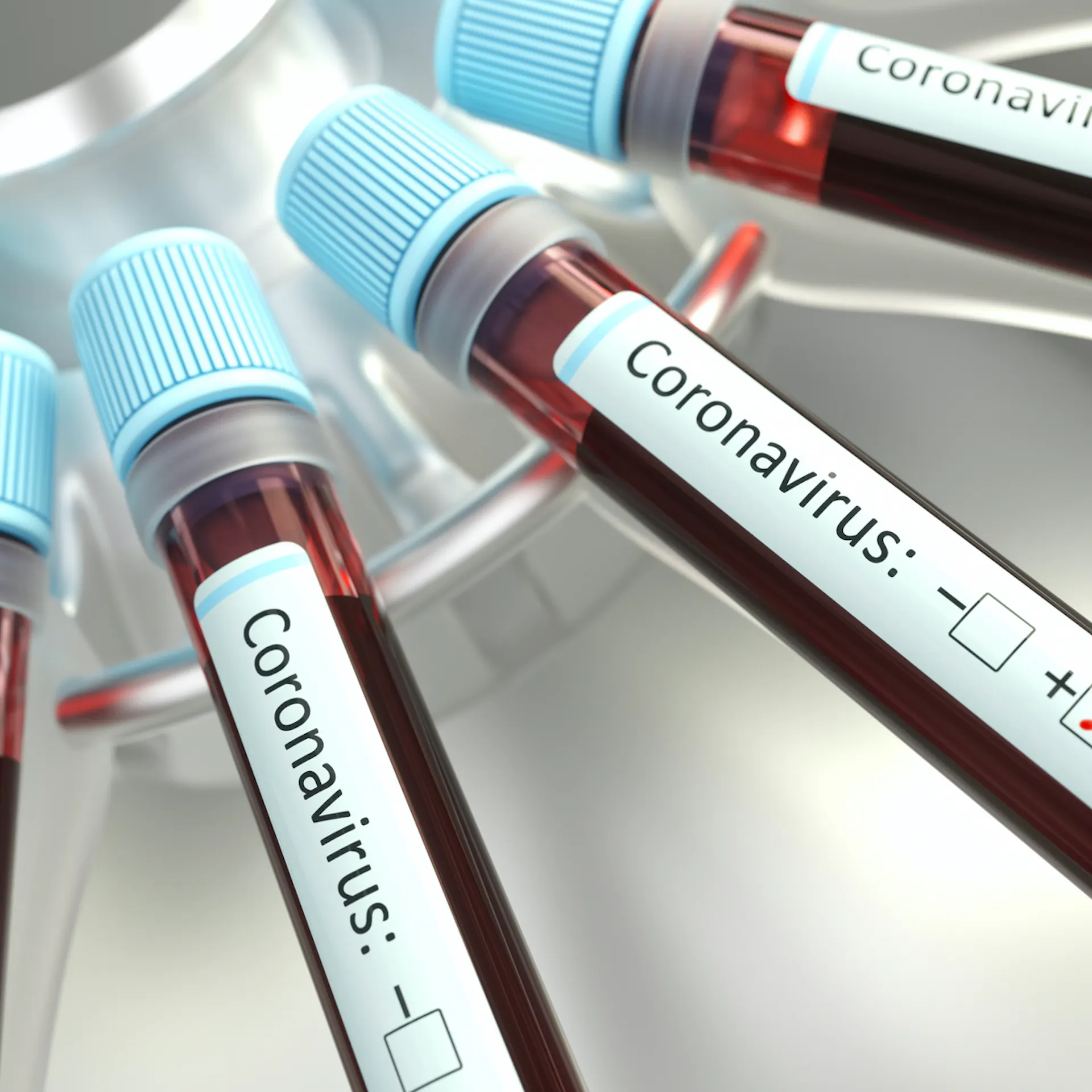 Four Lessons The Coronavirus Should Teach Us