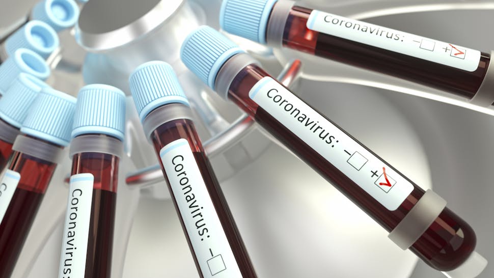Coronaviruses research, conceptual illustration Vials of blood in a centrifuge being tested for coronavirus infection.