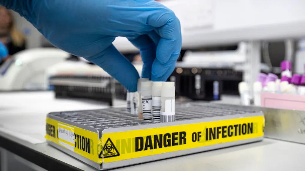 ‘Coronavirus Party’ Attendee Tests Positive For Coronavirus, Says Kentucky Governor