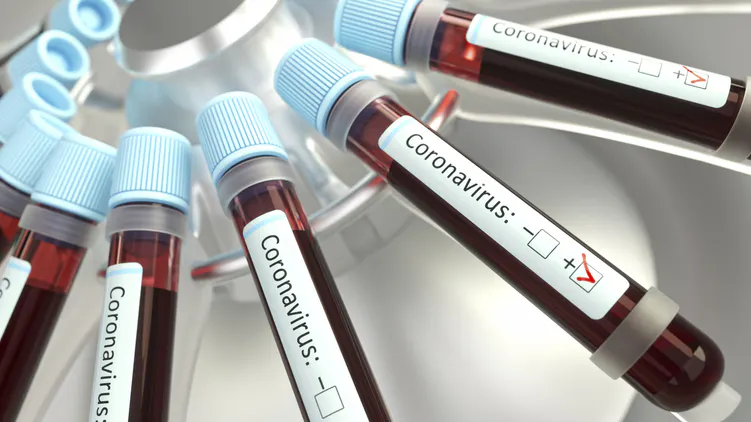 New Test Announced Could Determine If People Were Already Infected With Coronavirus And Are Now Immune
