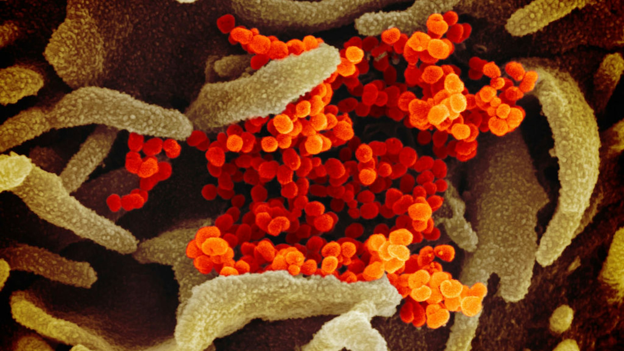 This scanning electron microscope image shows SARS-CoV-2 -also known as 2019-nCoV, the virus that causes COVID-19-isolated from a patient in the U.S., emerging from the surface of cells cultured in the lab.