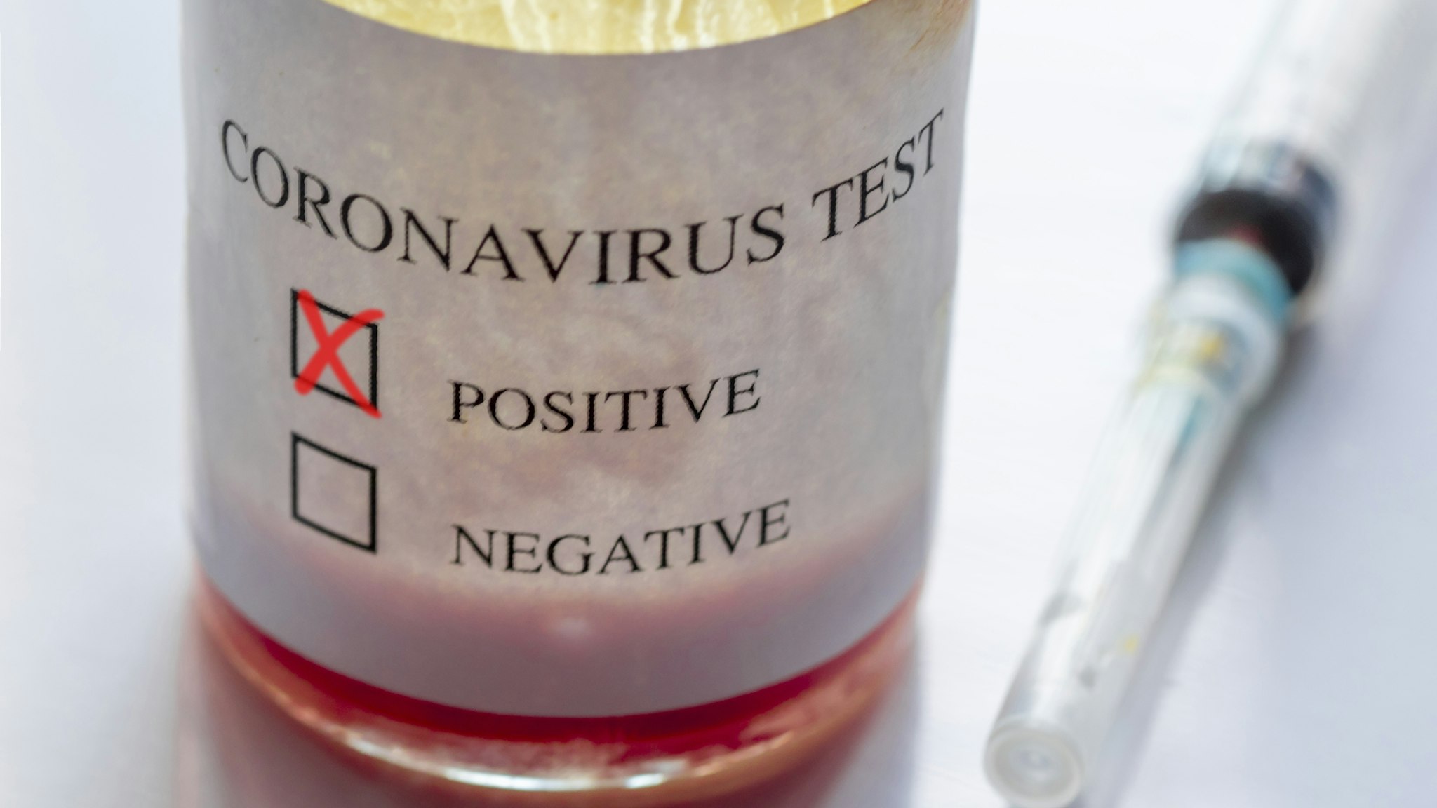 Coronavirus Positive Blood Test And Syringe - stock photo