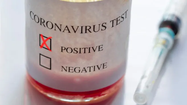 FDA Gives Emergency Approval To Blood Test To Find Who Has Antibodies, Is Immune To SARS-CoV-2