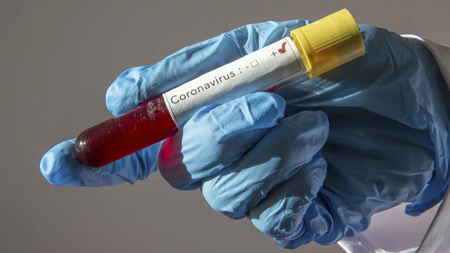 CURL: Who HAS The Coronavirus Is Not Nearly As Important As Who HAD The Virus