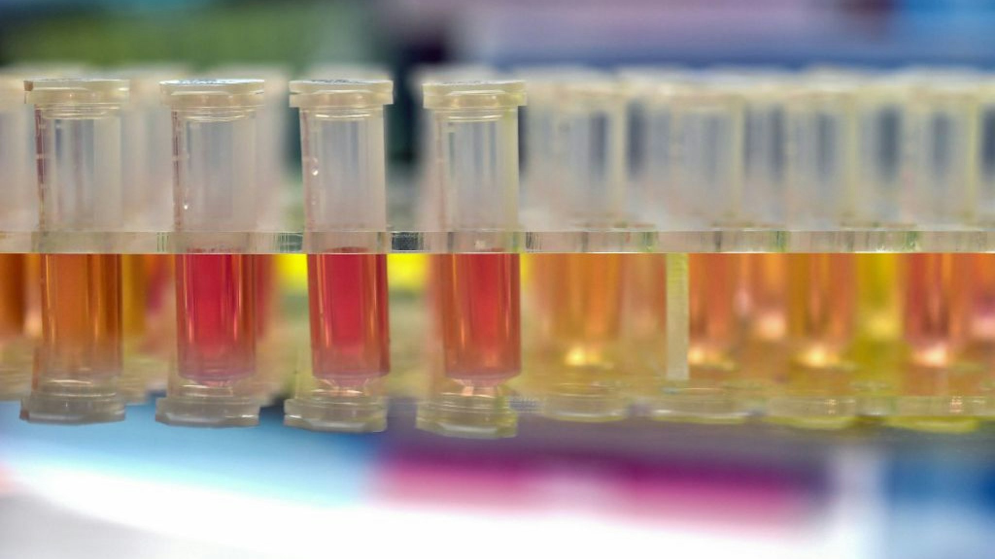 samples from people to be tested for the new coronavirus at "Fire Eye" laboratory in Wuhan