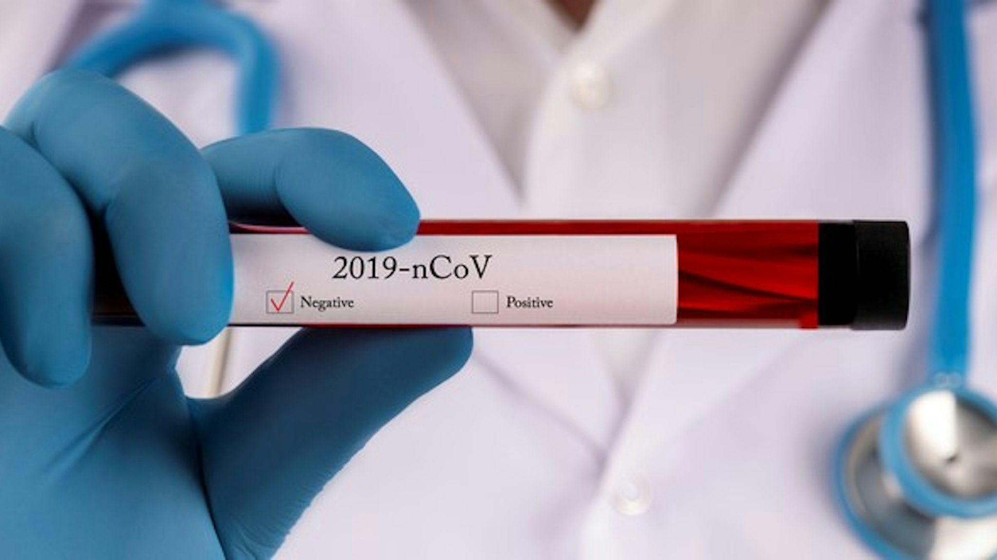 Coronavirus, Blood, Medical Test, Medical Research, Medical Sample