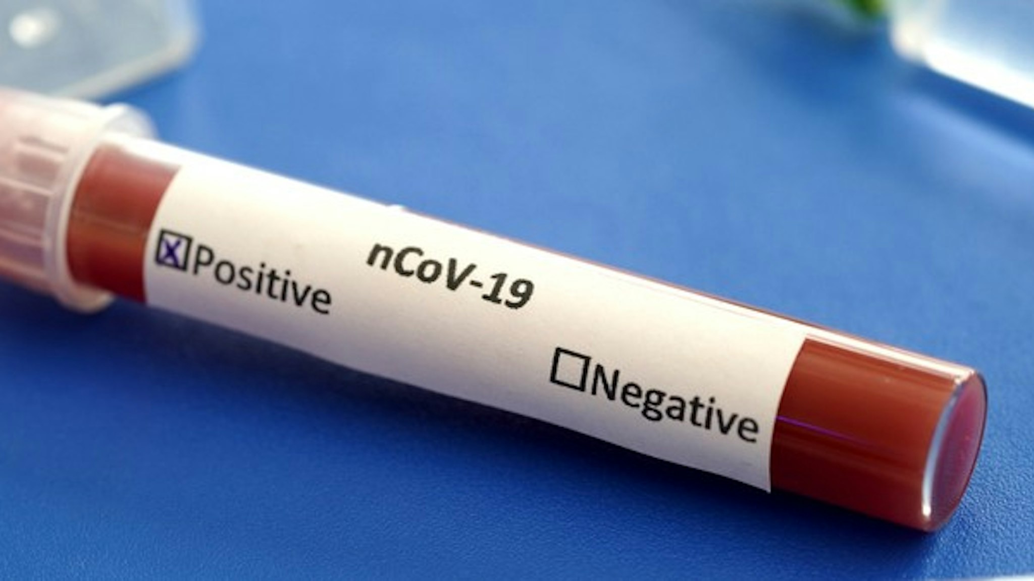 COVID19 test and laboratory sample of blood testing for diagnosis new Corona virus infection