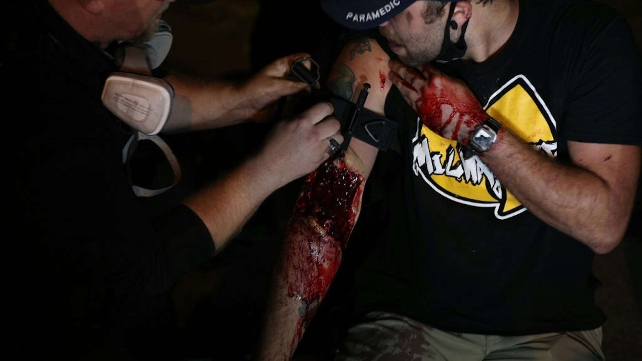 A man was shot in the arm as clashes between protesters and armed civilians who protect the streets of Kenosha against the arson during the third day of protests over the shooting of a black man Jacob Blake by police officer in Wisconsin, United States on August 25, 2020.