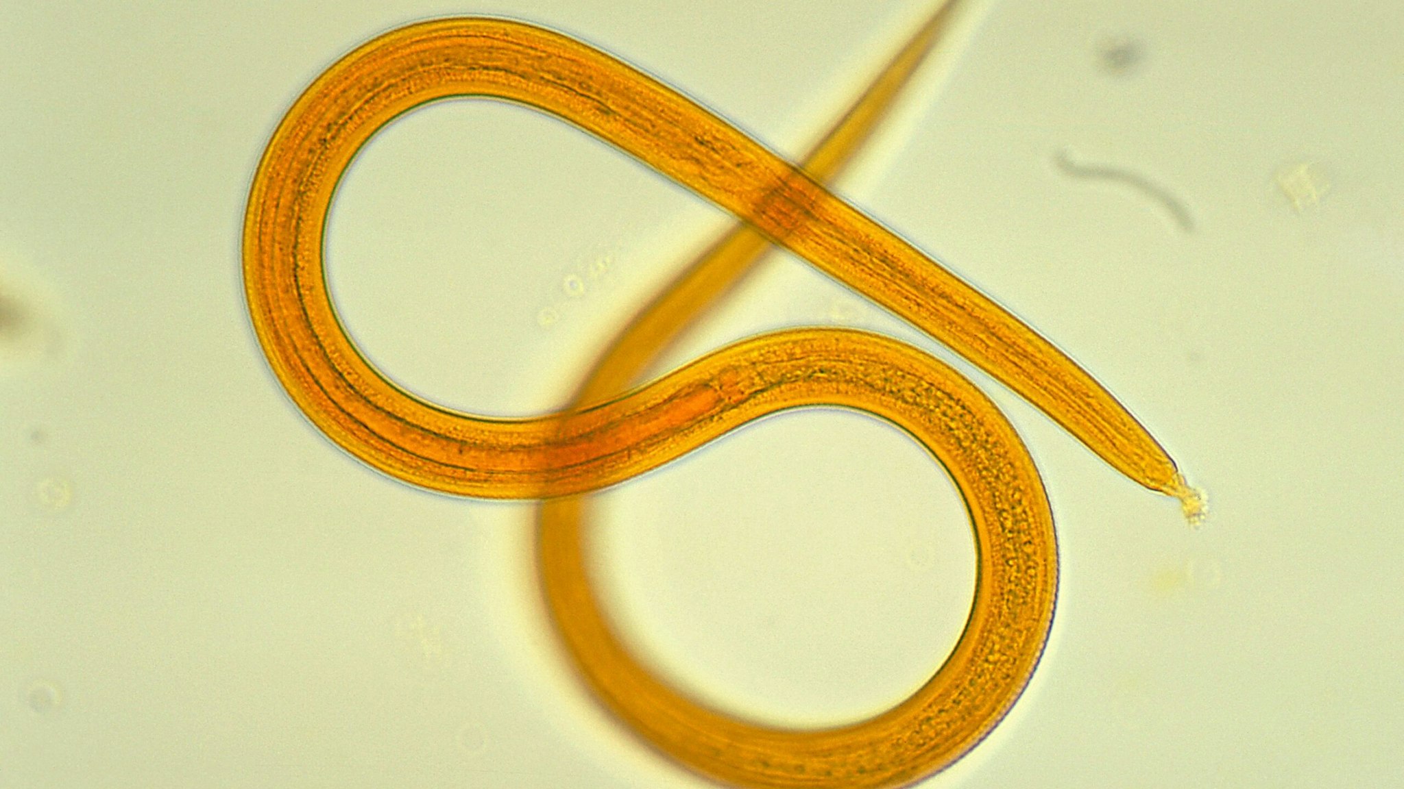 Roundworm, Nematode, Parasite, Strongyloides Filariform Larva. (Photo By BSIP/Universal Images Group via Getty Images)