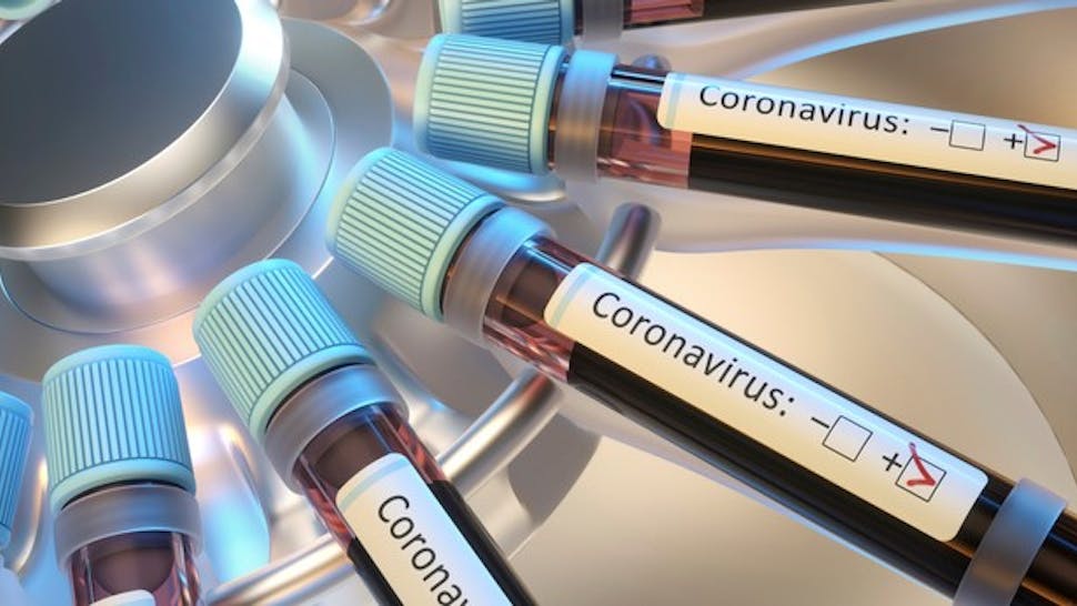 Coronaviruses research, conceptual illustration Coronaviruses research, conceptual illustration. Vials of blood in a centrifuge being tested for coronavirus infection.