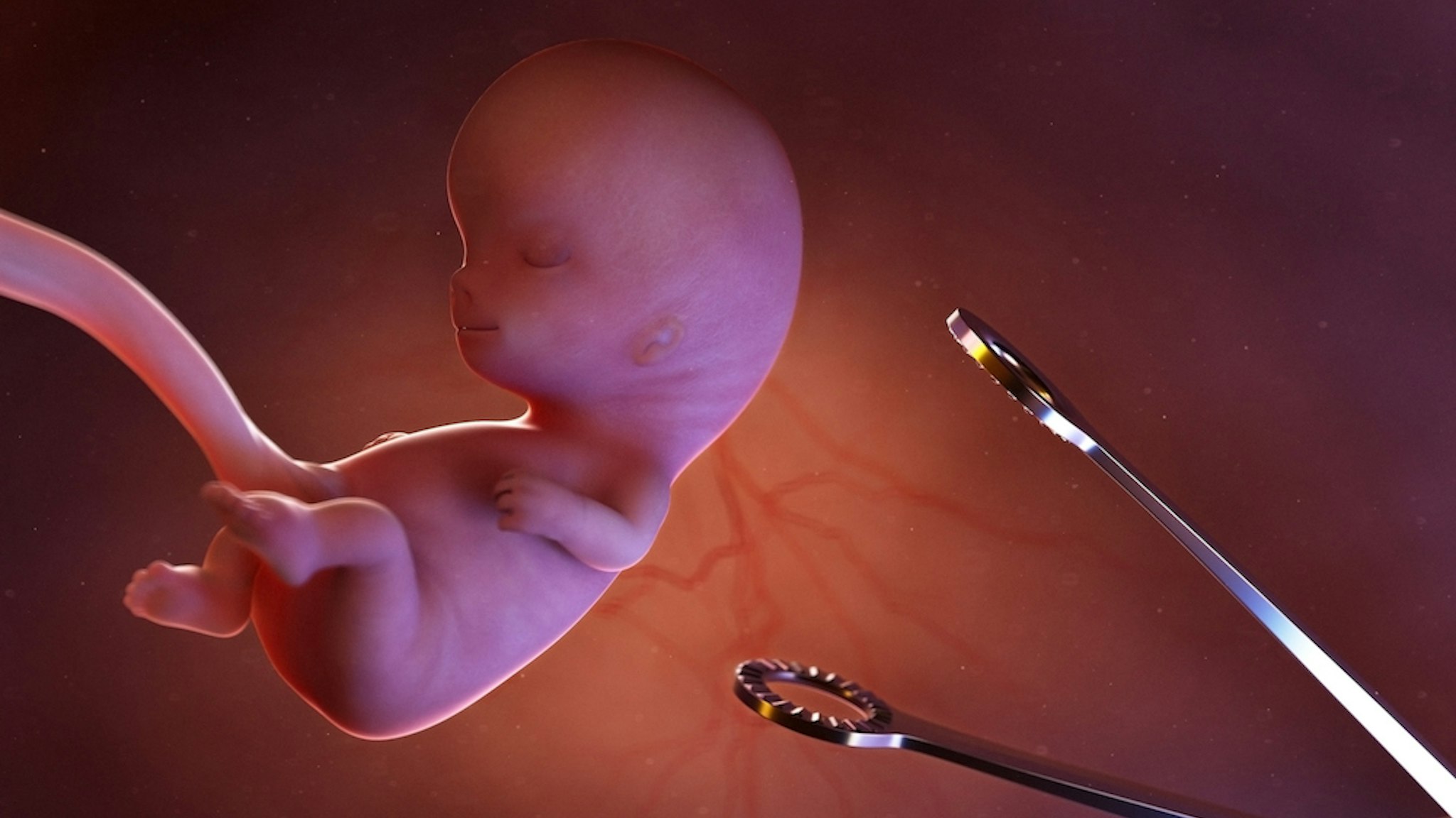 Abortion, conceptual illustration. (SEBASTIAN KAULITZKI/SCIENCE PHOTO LIBRARY via Getty Images)