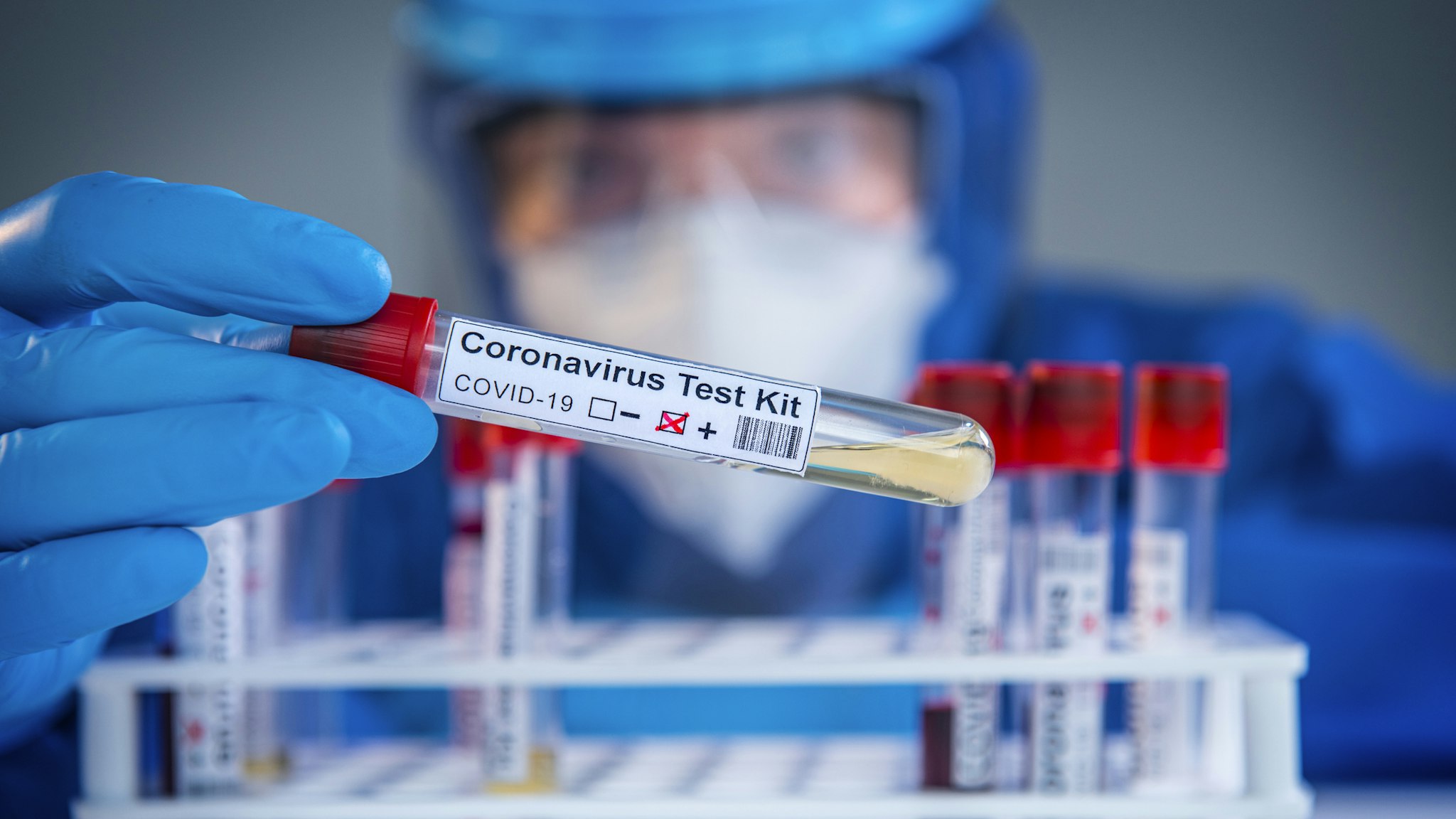 Examining coronavirus COVID 19 medical samples on kits novel corona virus outbreak - stock photo