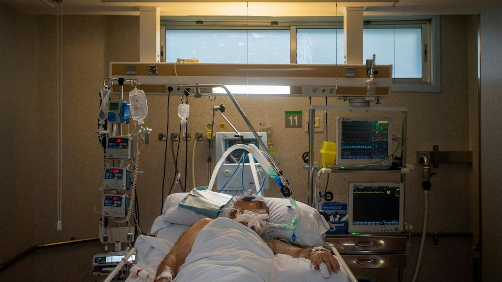 TOPSHOT - A COVID-19 coronavirus patient lies in bed at the Intensive Unit Care of the Povisa Hospital in Vigo, northwestern Spain, on April 16, 2020. - Spain's coronavirus death toll soared past 19,000 with another 551 deaths, but questions over the counting method have raised some regional concerns the real figure is much higher. (Photo by MIGUEL RIOPA / AFP) (Photo by MIGUEL RIOPA/AFP via Getty Images)