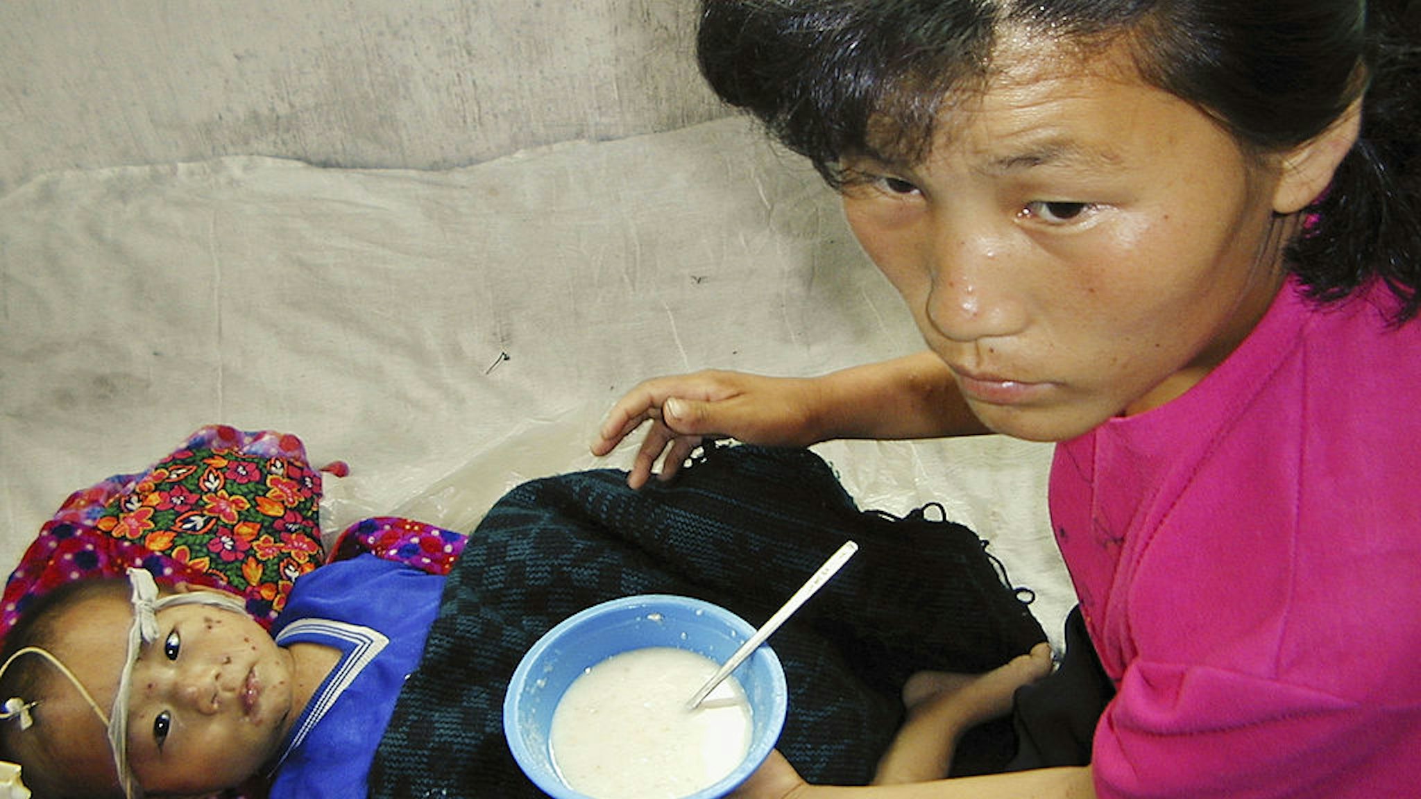 PYONGYANG, NORTH KOREA - AUGUST 4: In this handout from the World Food Programme, a malnourished North Korean boy, 3 year-old Jong Song Chol, is fed a vitamin and mineral-enriched porridge supplied by the United Nations World Food Programme at a hospital in Sinyang county, on August 4, 2004 in South Pyongyang province, North Korea. The United Nations World Food Programme says that millions of North Koreans are chronically malnourished. (Photo by Gerald Bourke/WFP via Getty Images)