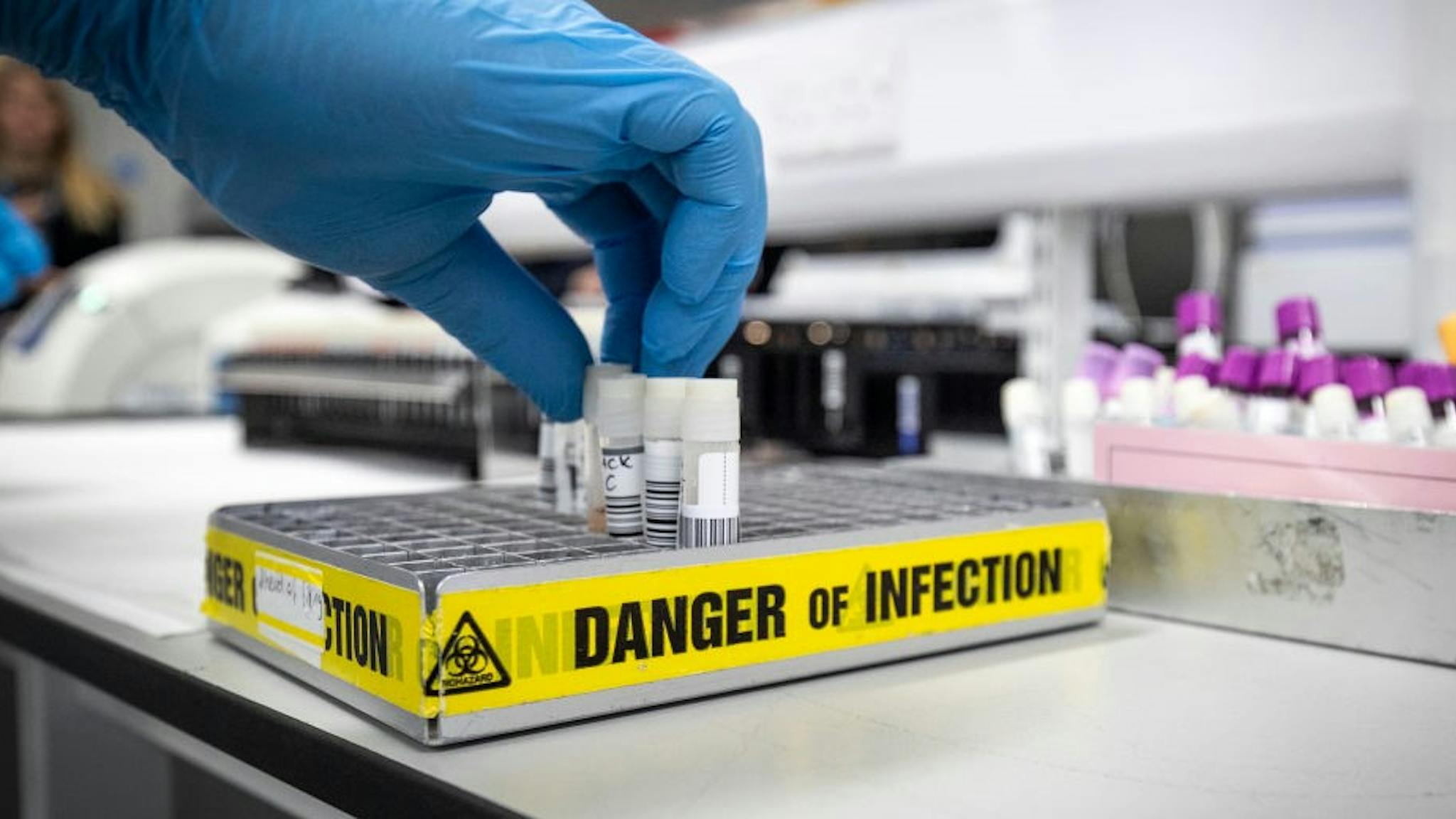 Coronavirus Testing Laboratory In Glasgow GLASGOW, SCOTLAND - FEBRUARY 19: Clinical support technician Douglas Condie extracts viruses from swab samples so that the genetic structure of a virus can be analysed and identified in the coronavirus testing laboratory at Glasgow Royal Infirmary, on February 19, 2020 in Glasgow, Scotland. (Photo by