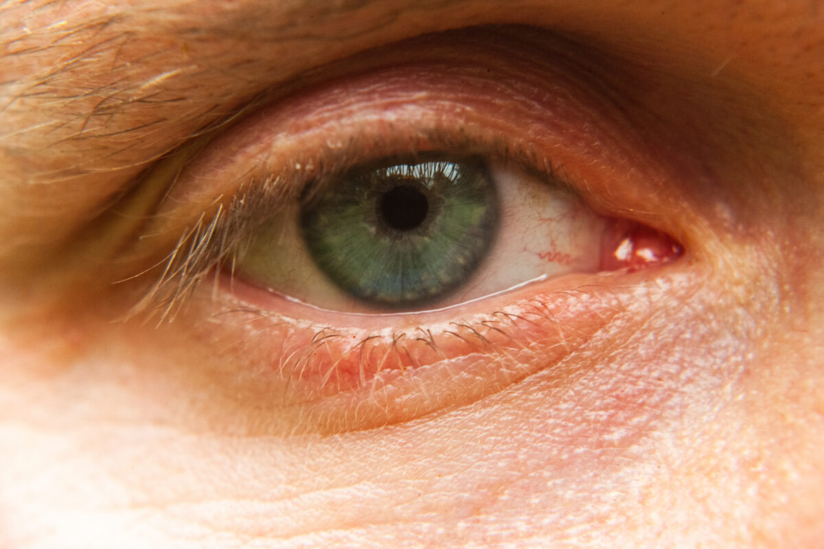 Blind man regains sight after Israelis implanted artificial cornea