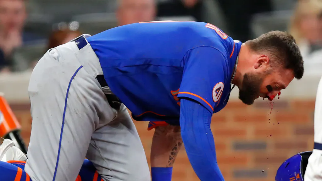 VIDEO: Mets’ Player Suffers Multiple Fractures After Being Hit In The Face By 94 MPH Fastball