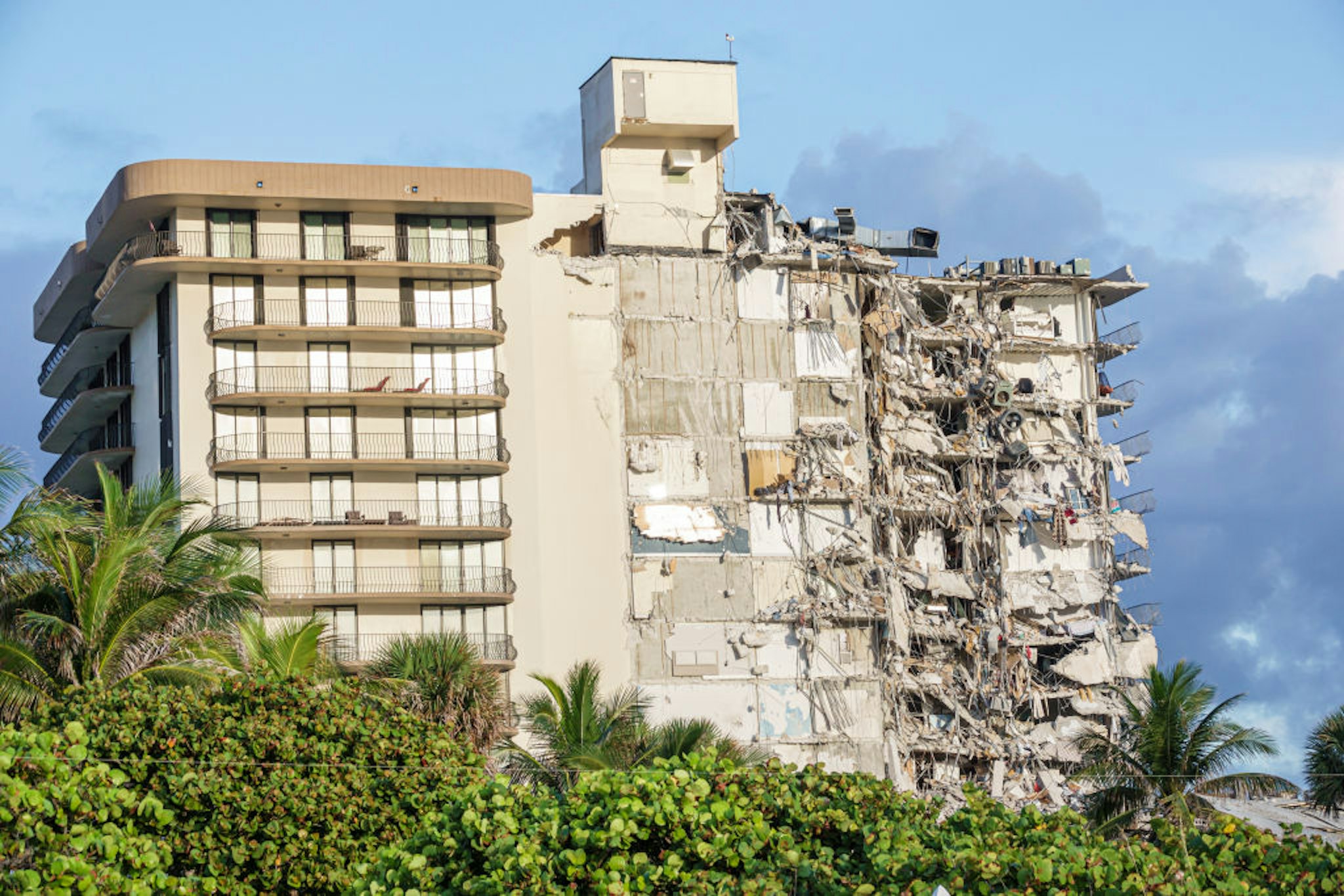 Damage caused by the partial collapse of the Champlain Towers condominium building, Surfside, Miami Beach, Florida. (Photo by: Jeff Greenberg/Universal Images Group via Getty Images)