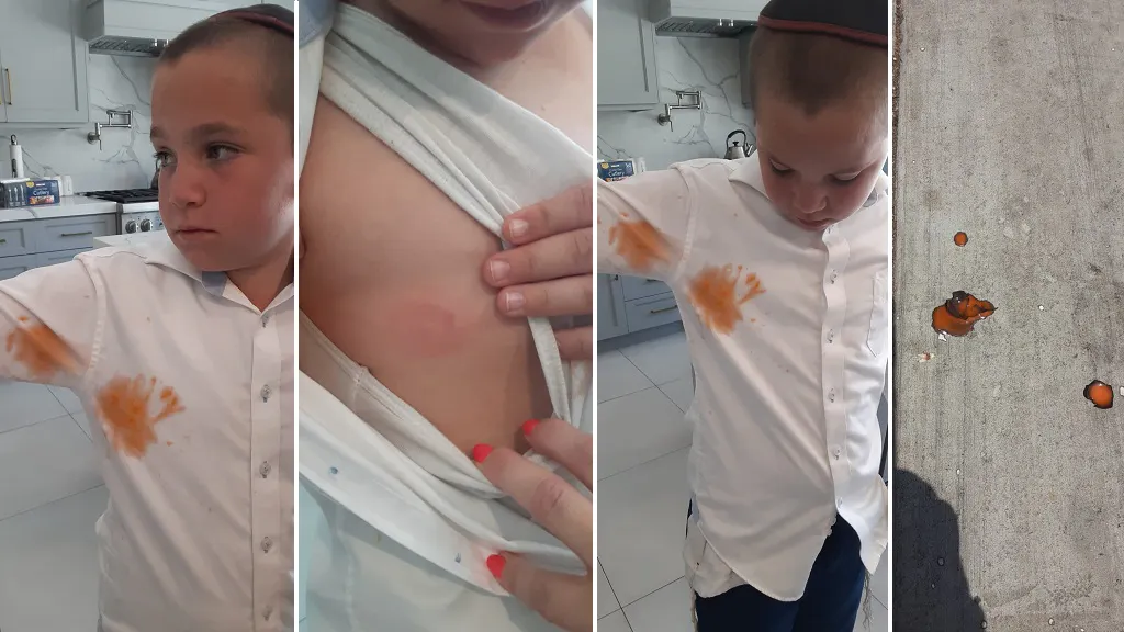 LAPD Investigating Reported Paintball Attack On 11-Year-Old Jewish Boy As Possible Hate Crime