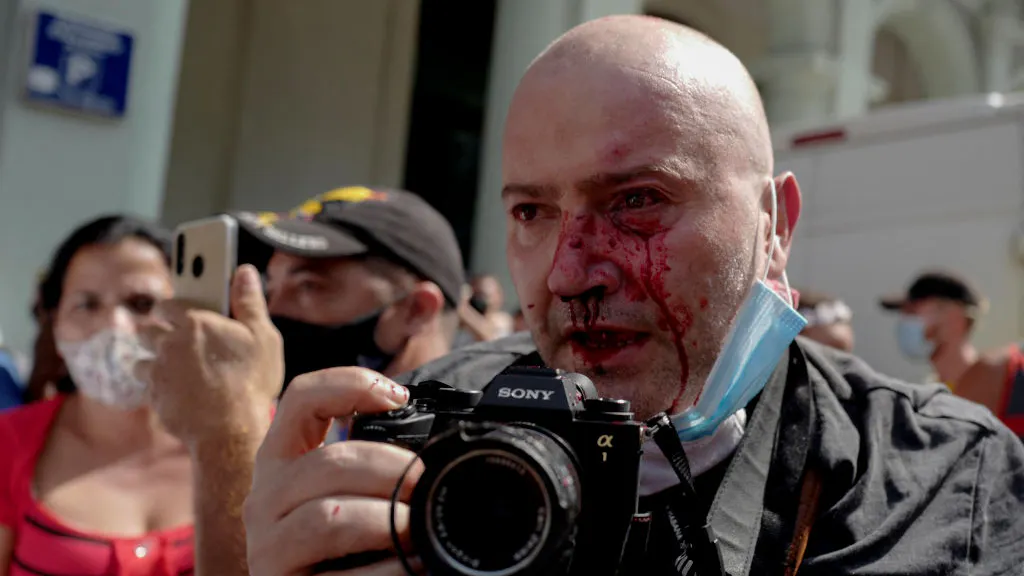 Communist Cuba: AP Journalist Beaten, Bloodied By Police While Covering Freedom Protests