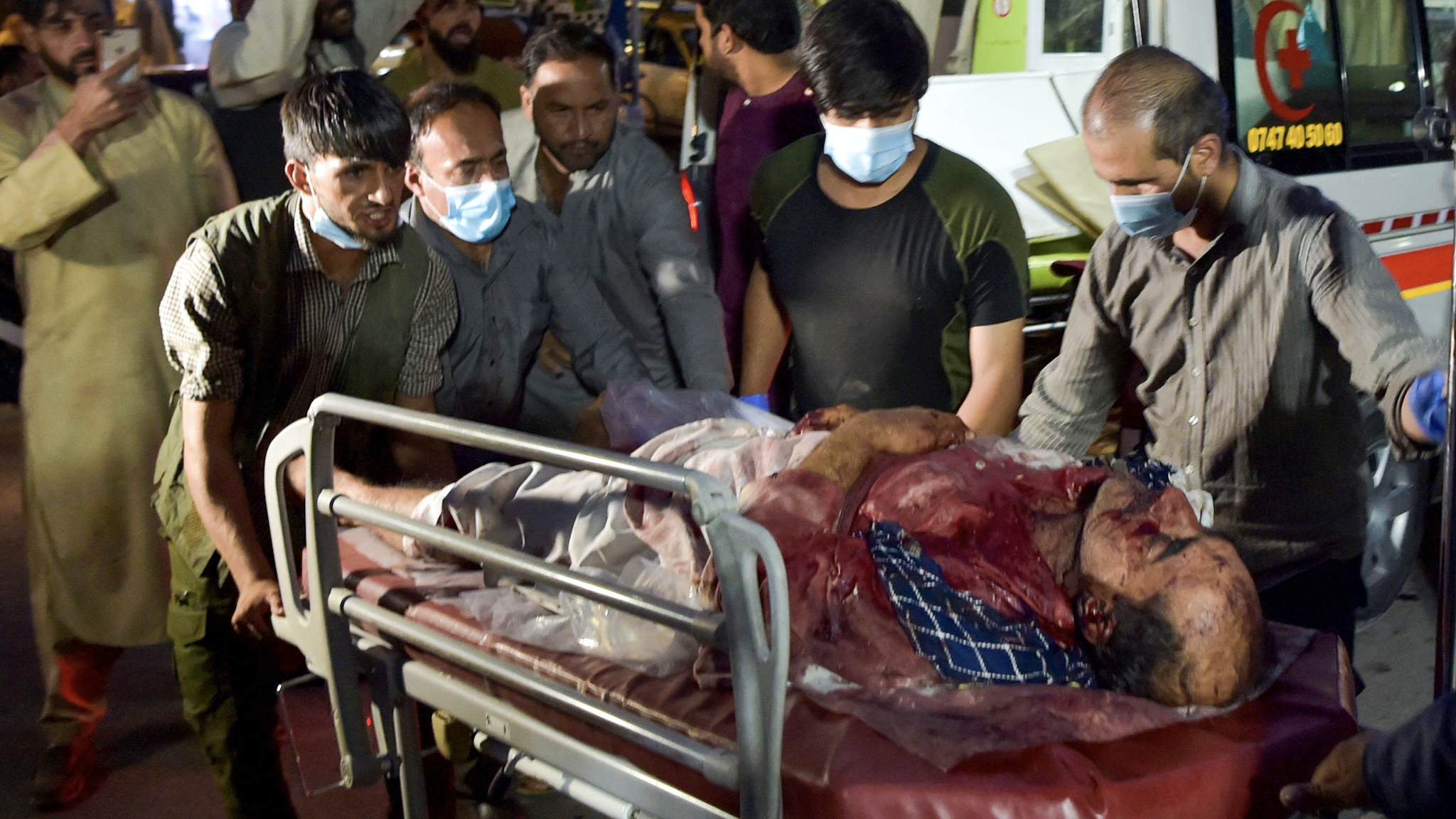 Graphic content / Volunteers and medical staff bring an injured man for treatment after two powerful explosions, which killed at least six people, outside the airport in Kabul on August 26, 2021.