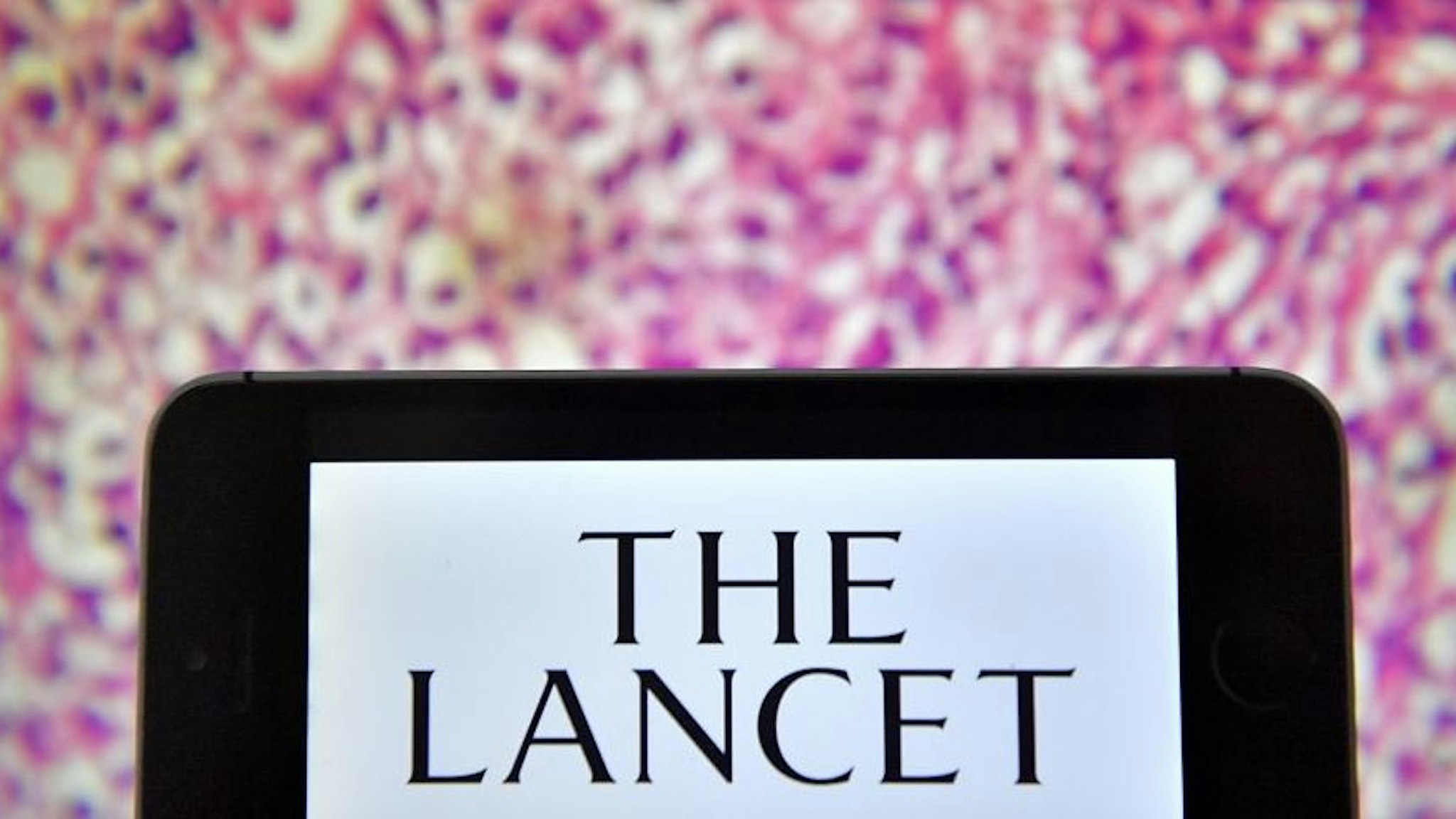 A picture taken on November 20, 2017 shows the logo of British peer-reviewed general medical journal The Lancet displayed on a computer's screen.