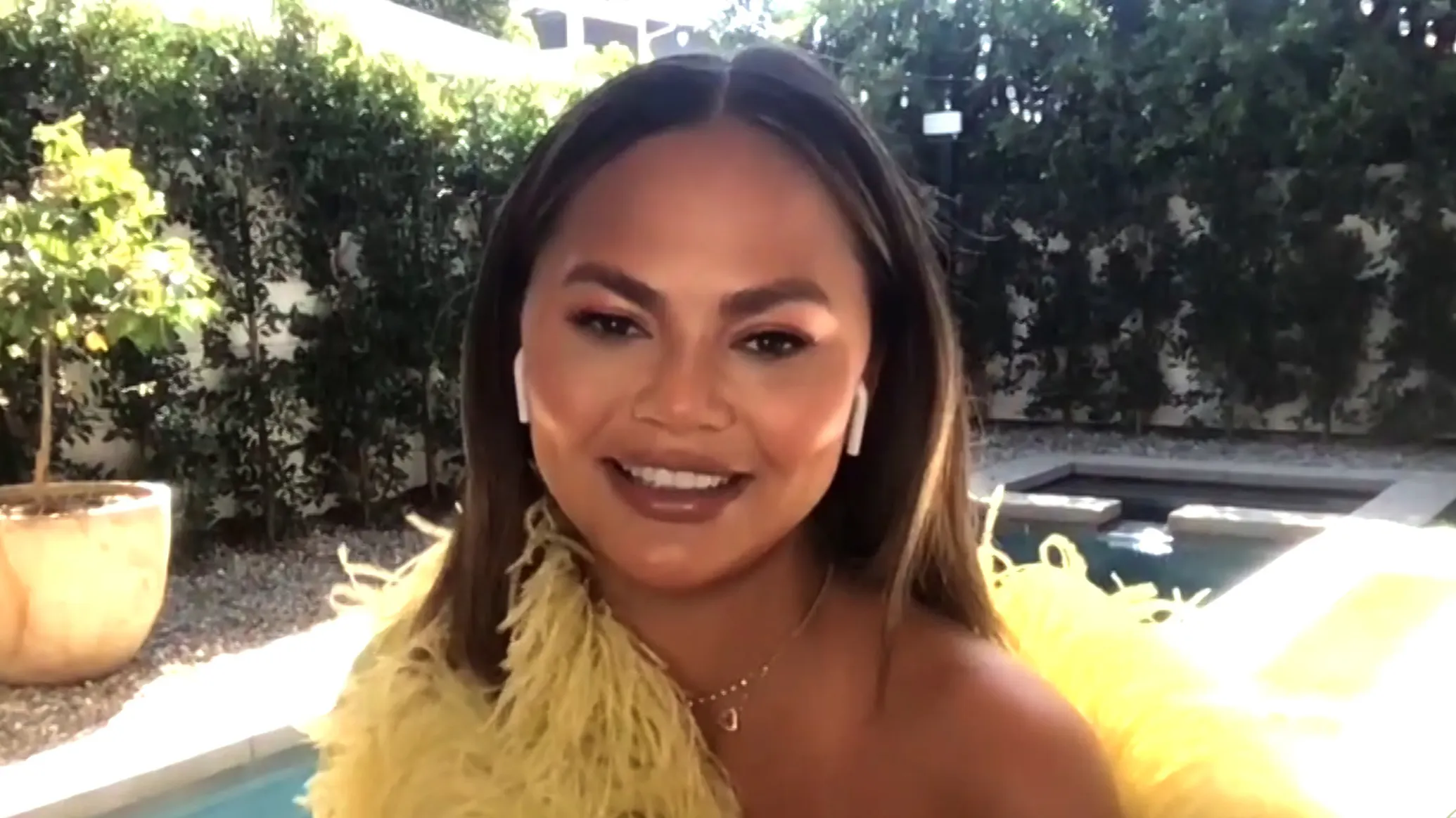 Chrissy Teigen Shares Update Despite Backlash Over ‘Out-of-Touch’ Eyebrow Transplant