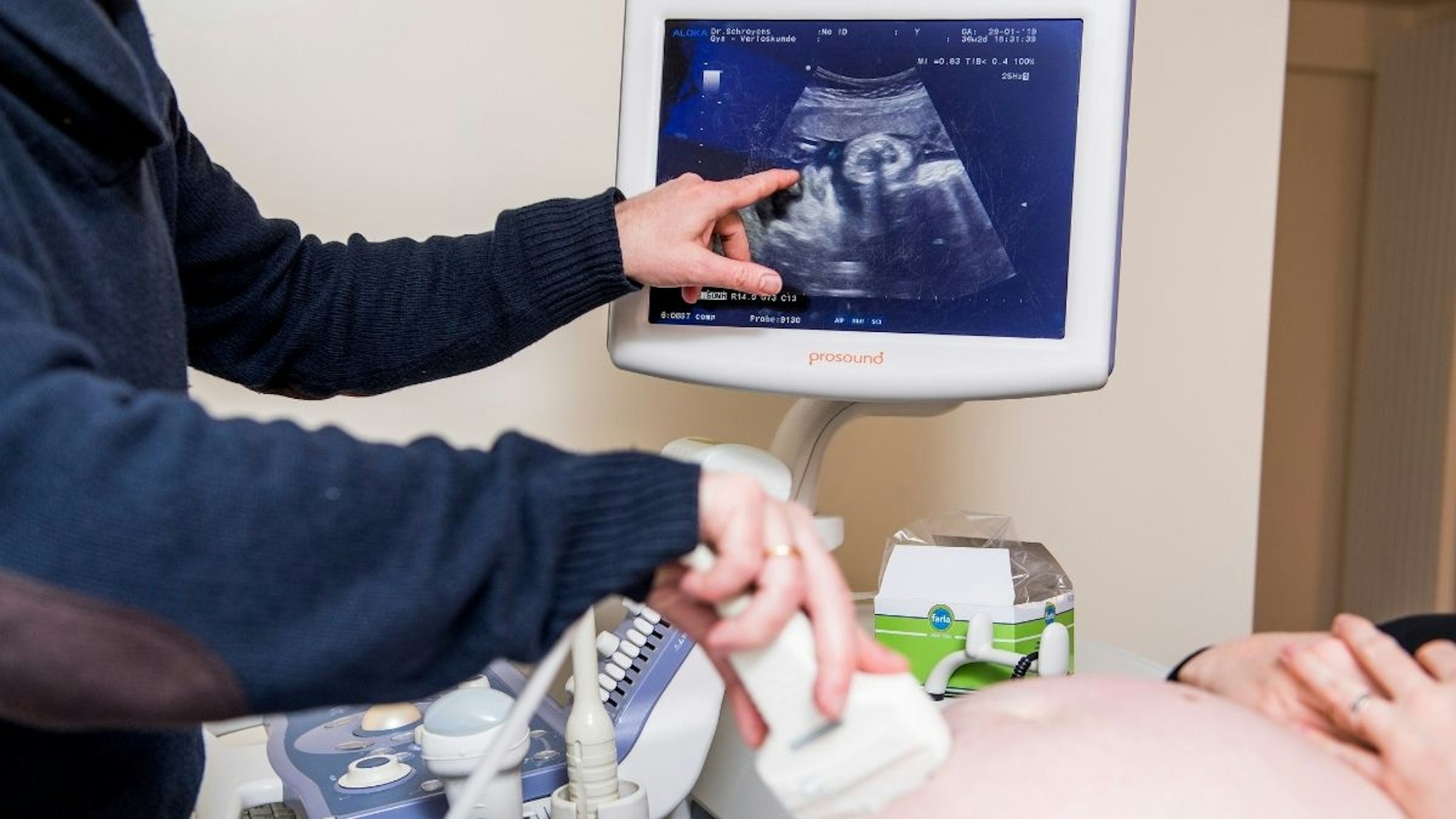 Illustration picture shows a doctor doing an ultrasound examination during a visit of a pregnant woman to her gynaecologist, in Mechelen, Thursday 31 January 2019.