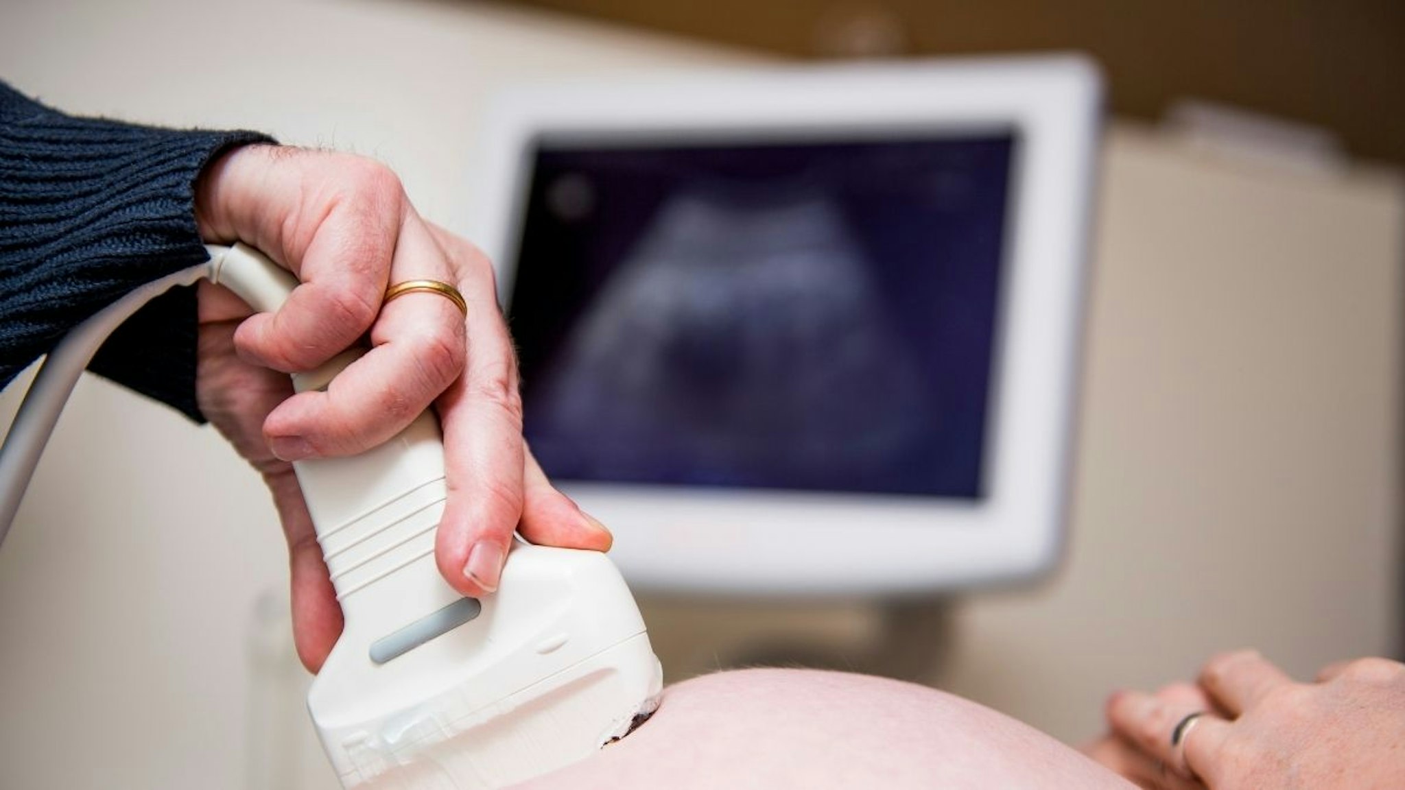 Illustration picture shows a doctor doing a ultrasound examination during a visit of a pregnant woman to her gynaecologist, in Mechelen, Thursday 31 January 2019.