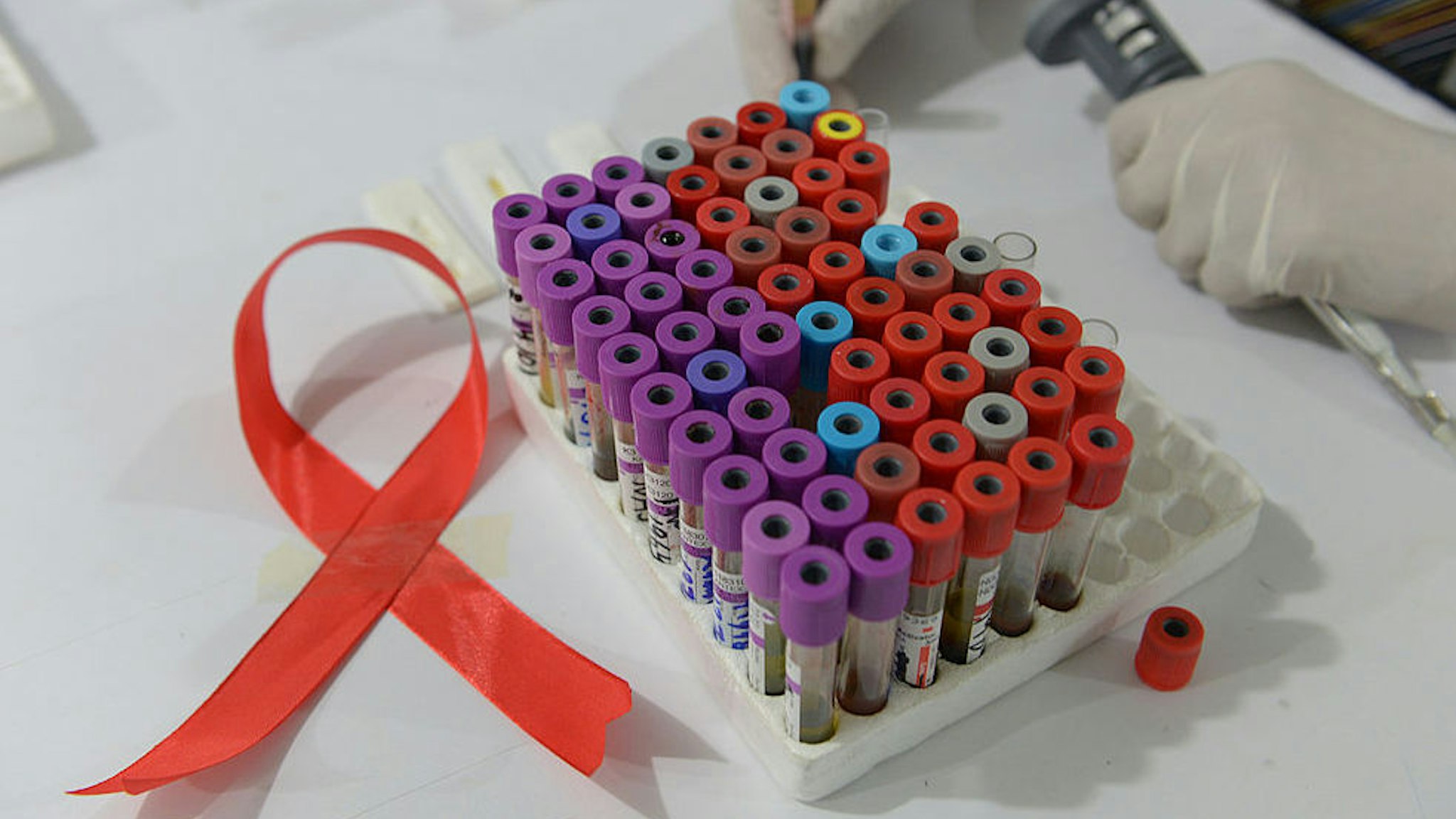 A Pakistani technician takes samples in a laboratory alongside a ribbon promoting the forthcoming World Aids Day in Islamabad on November 30, 2013.