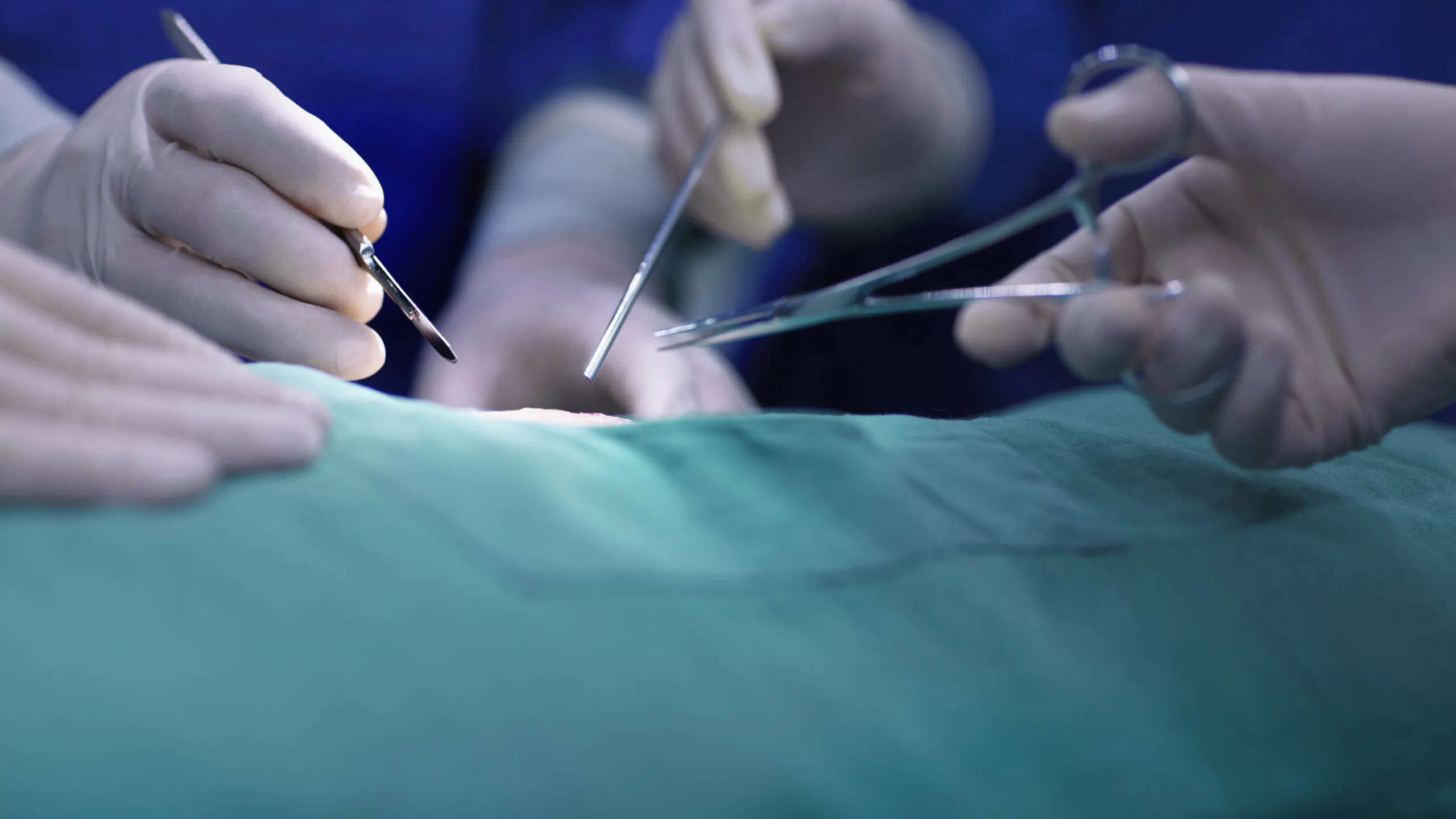 Doctors Took Out Wrong Organ In Botched Surgery That Took Five Specialists To Unravel: Lawsuit