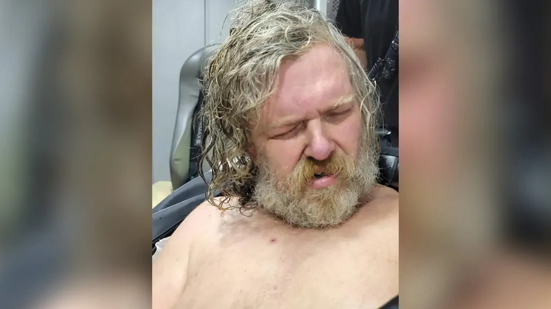 Brother Accused Of Hatchet Attack That Put Sister In 2-Year Coma Dies After She Points Finger