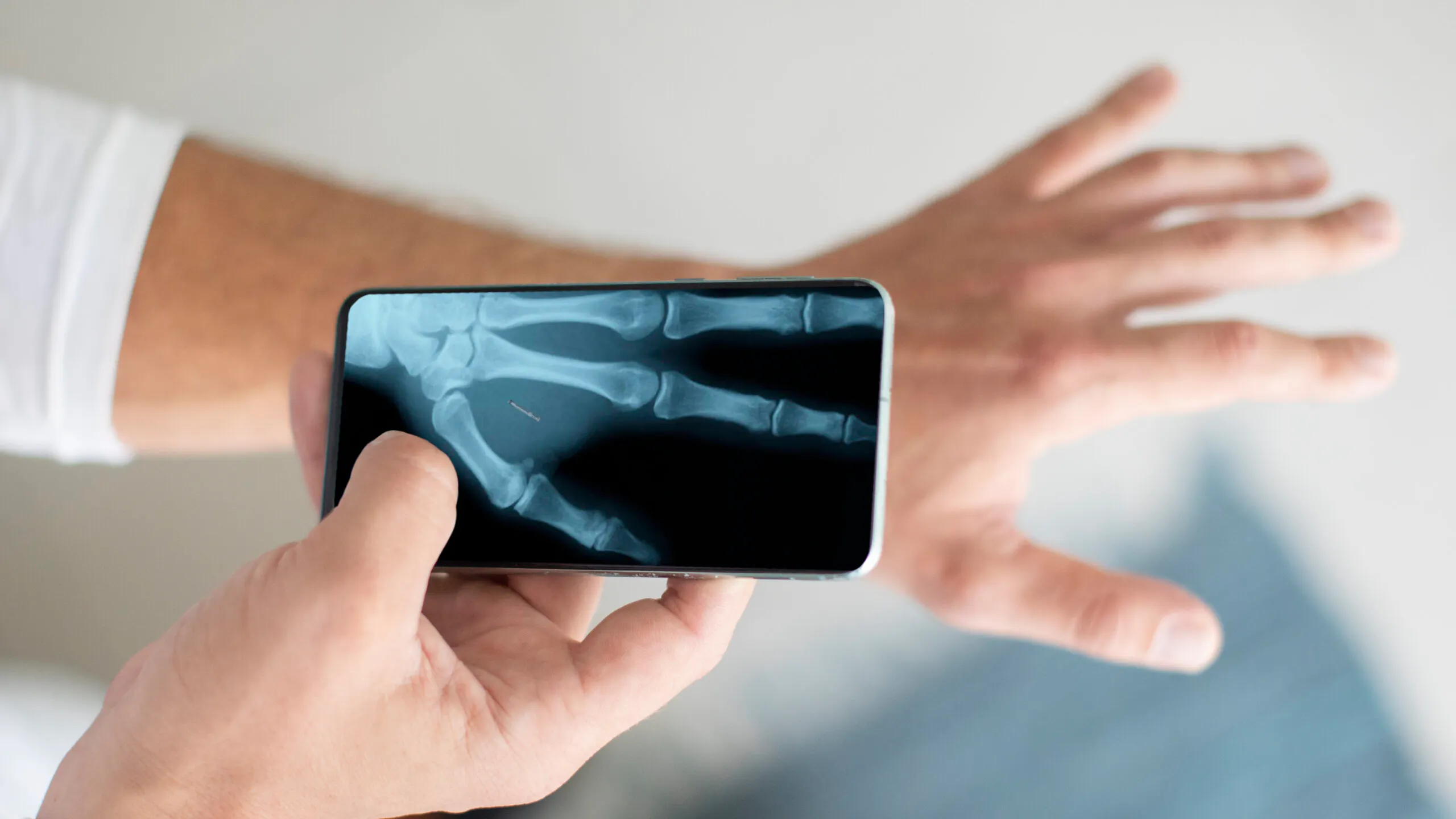 Man Marks Himself With Microchips Underneath Skin To Unlock Car, Pay For Goods And Store Data