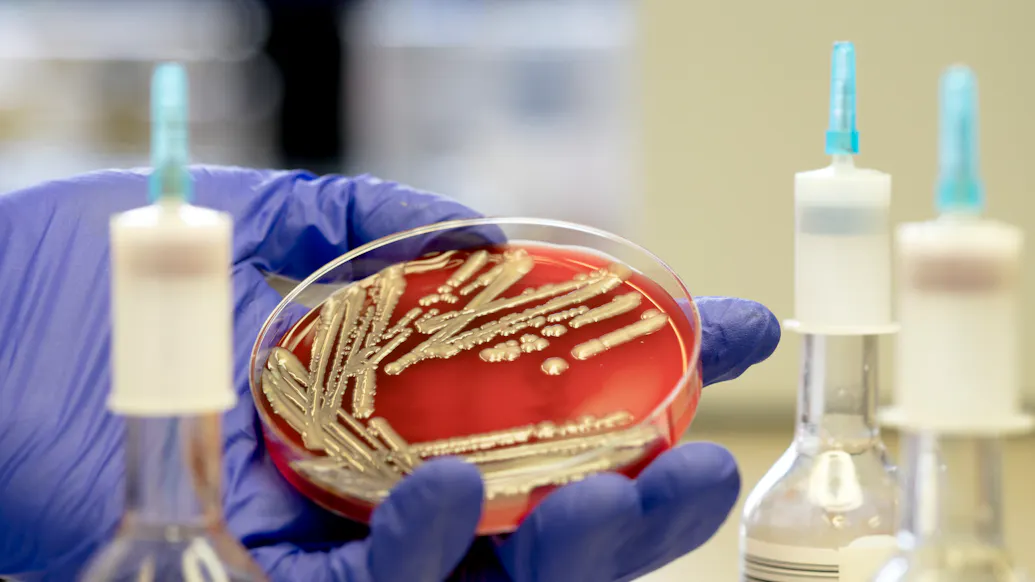‘Fast-Moving’ E. Coli Outbreak Infects Michigan And Ohio: Health Officials
