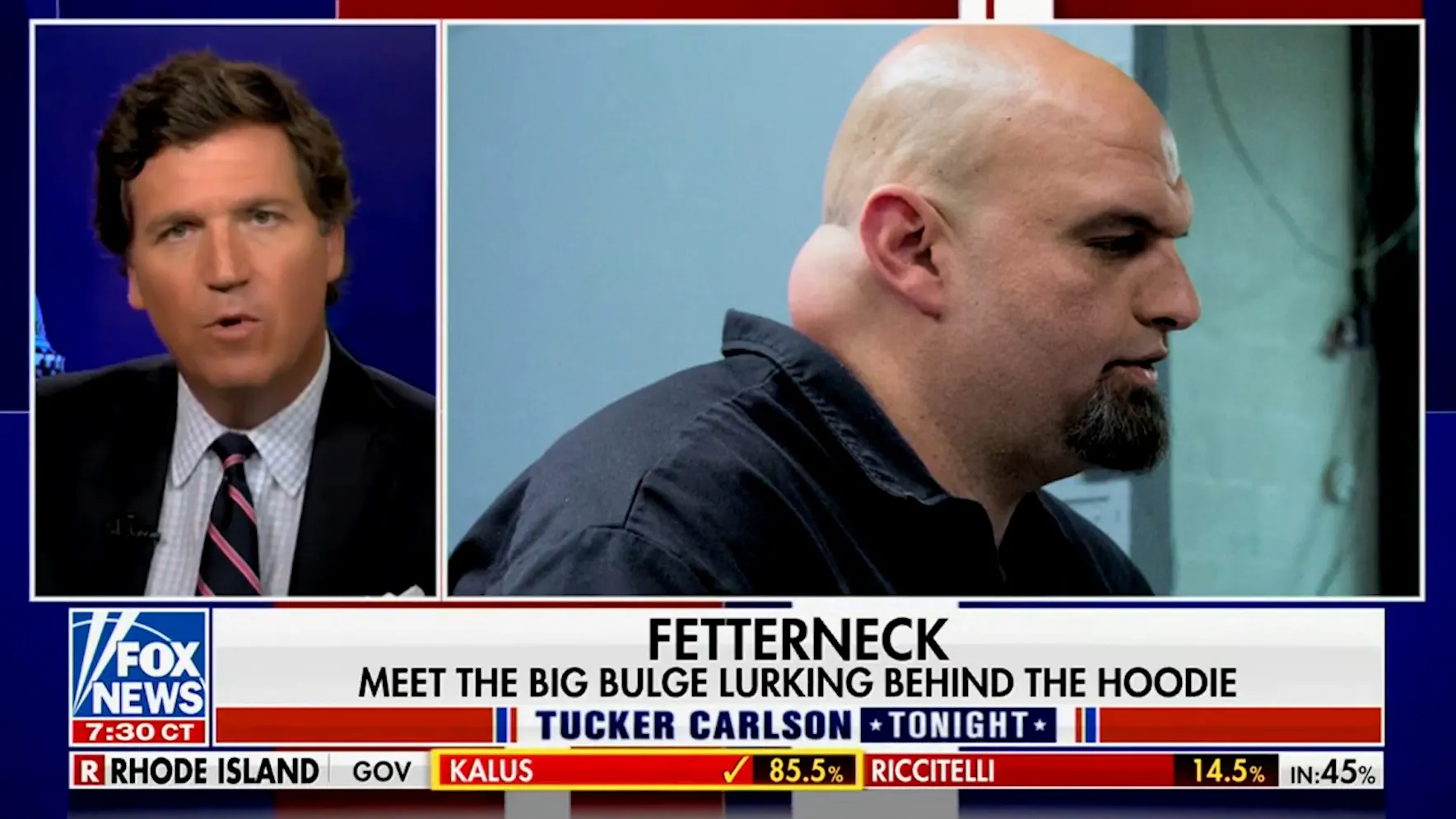 Tucker Carlson Calls Out Large Bump On John Fetterman’s Neck: ‘Keep Your Eyes On This Lump’