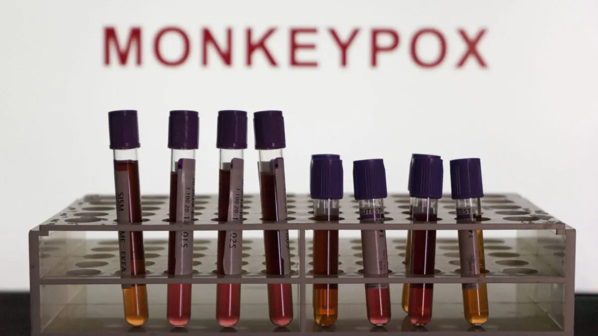 NYC Will No Longer Refer To Virus As Monkeypox To Avoid ‘Inaccurate And Stigmatizing Label’