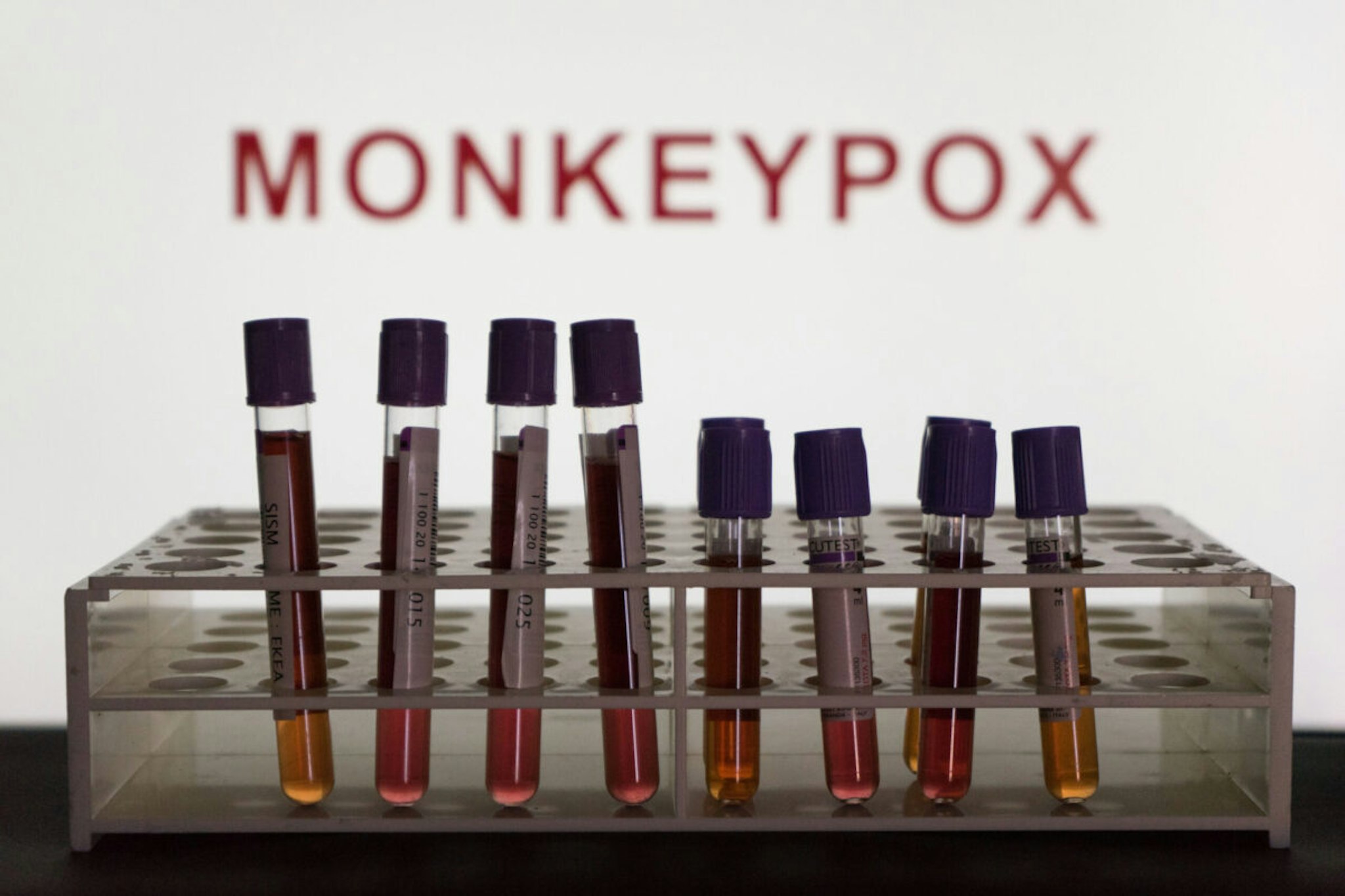 In this photo illustration blood test vials are seen in front of a screen that says &quot;Monkeypox&quot;.
