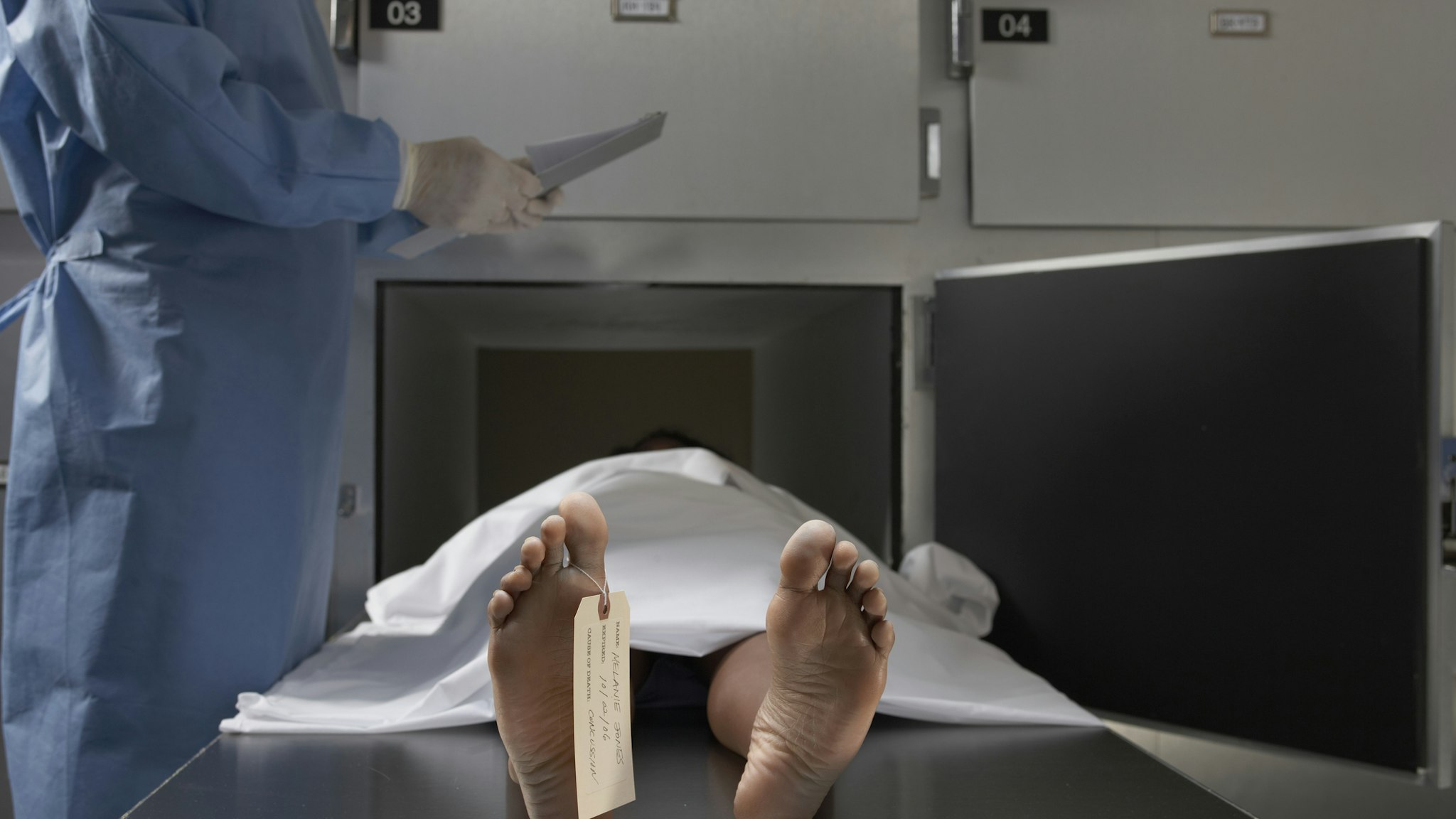 "Cadaver on autopsy table, label tied to toe, close-up" - stock photo