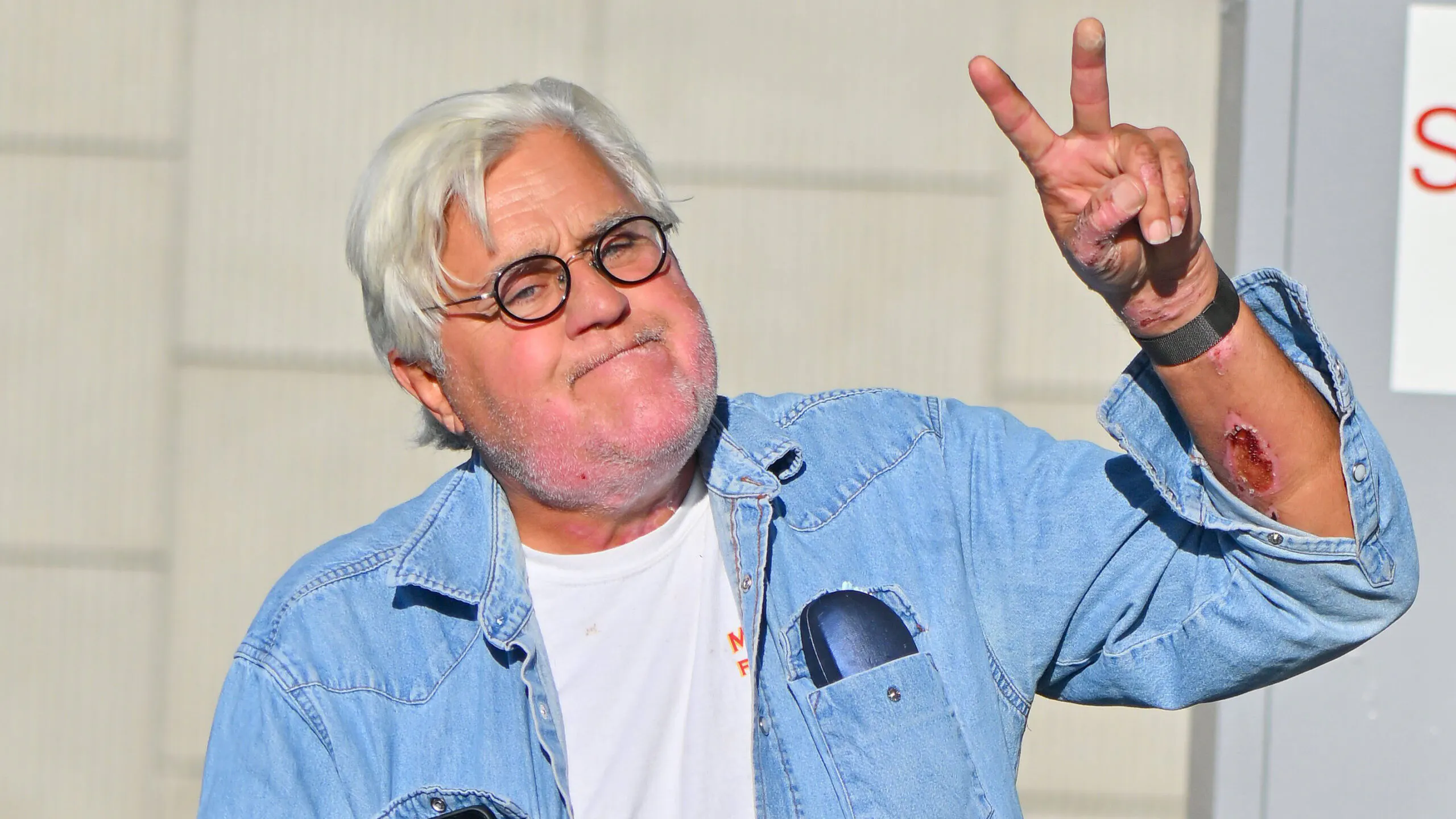 WATCH: Jay Leno Hits Police Car On Way To Perform On Stage For First Time Since Burn Accident