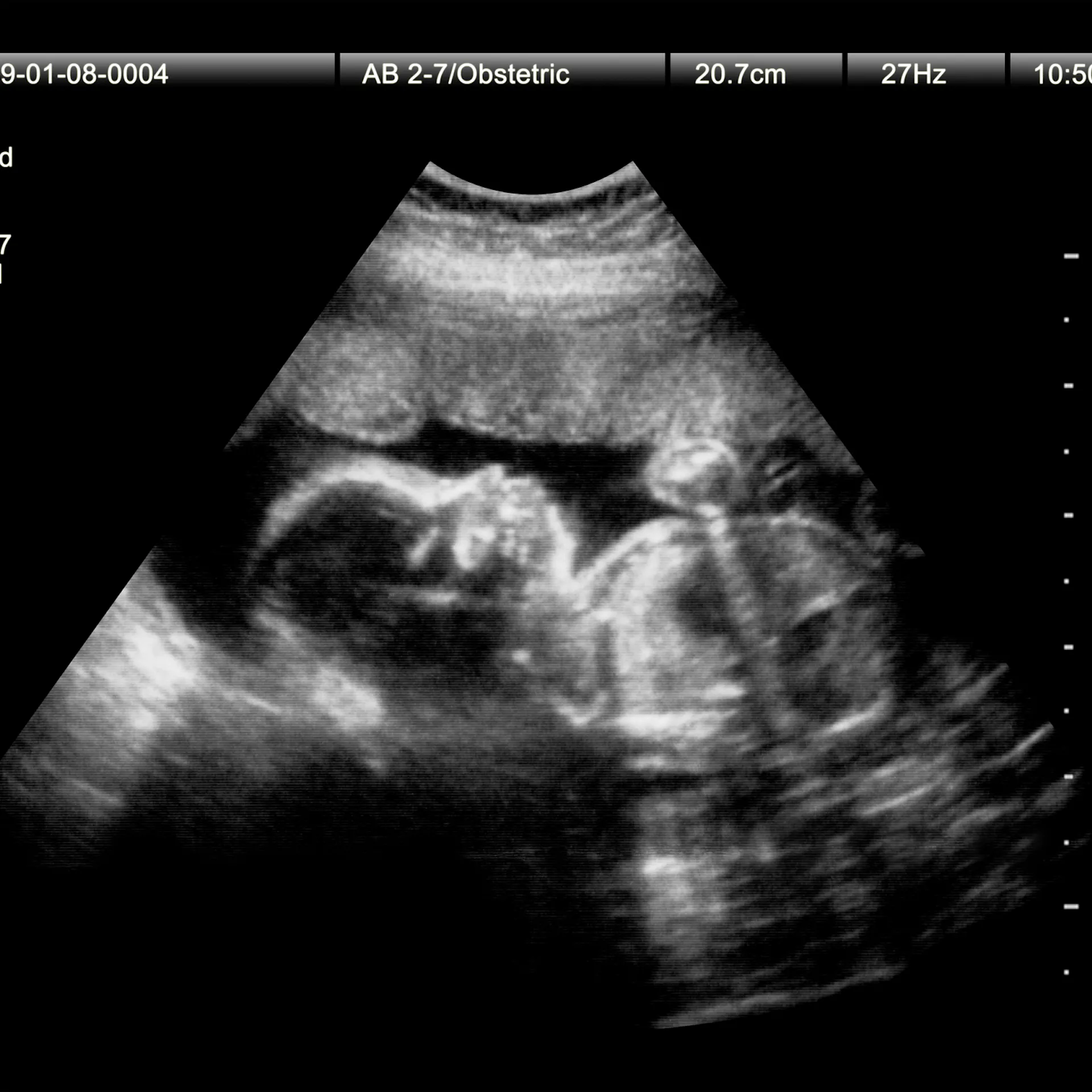 Newspeak: AP Stylebook Bans Term ‘Late-Term Abortion,’ Prefers ‘Abortion Later In Pregnancy’