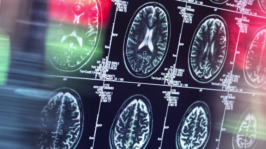 Scientists Discover An Added Layer Of Complexity To Brain Anatomy ...