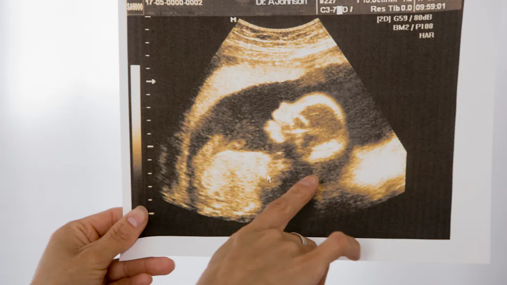 New York City-Run Clinics To Offer Free Abortion Pills Amid Lawsuit Against ‘Dangerous’ FDA Approved Drugs