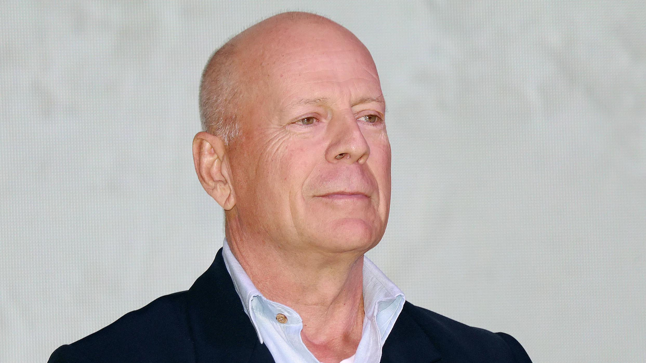 Bruce Willis Diagnosed With Frontotemporal Dementia