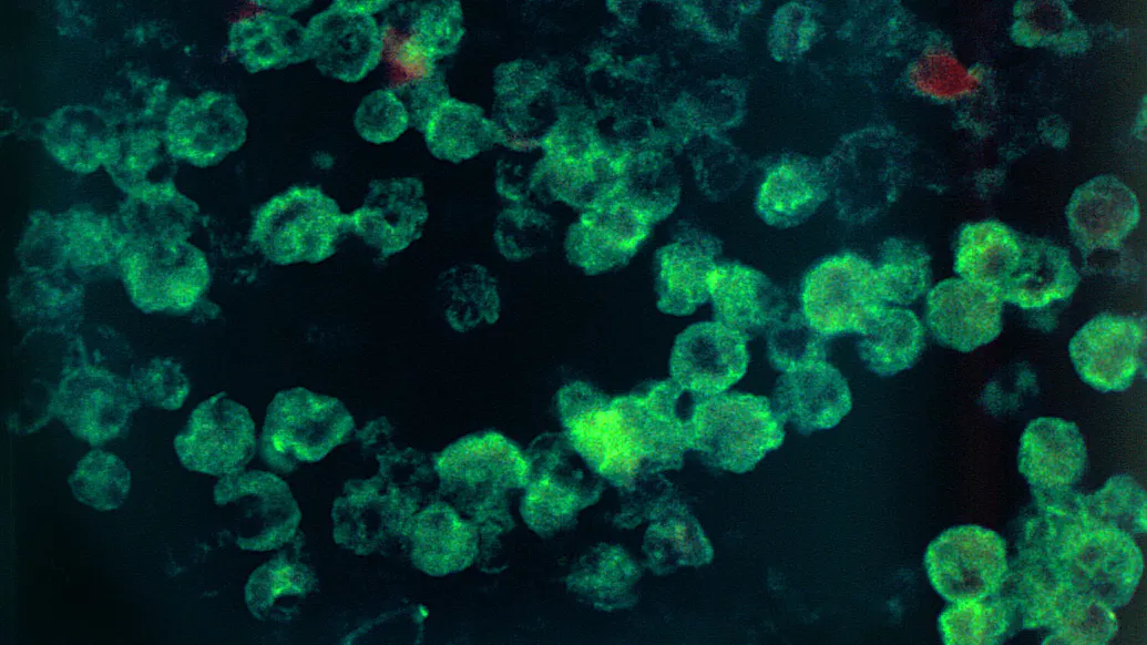 Brain-Eating Amoeba From Unboiled Tap Water Kills Florida Man