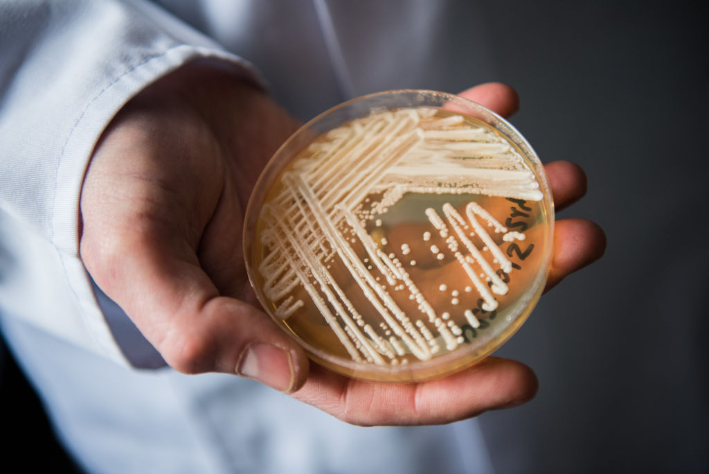 Deadly Drug-Resistant Fungus Spreading In Hospitals Across U.S.
