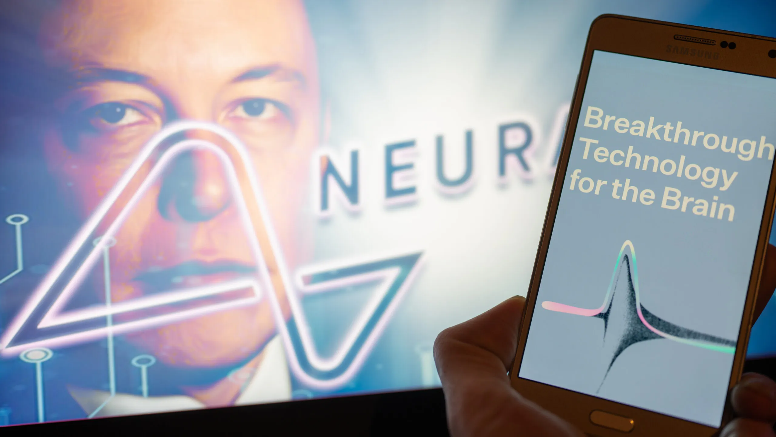 Elon Musk’s Neuralink Startup Receives FDA Approval For First In-Human Brain Chip Implant Clinical Study