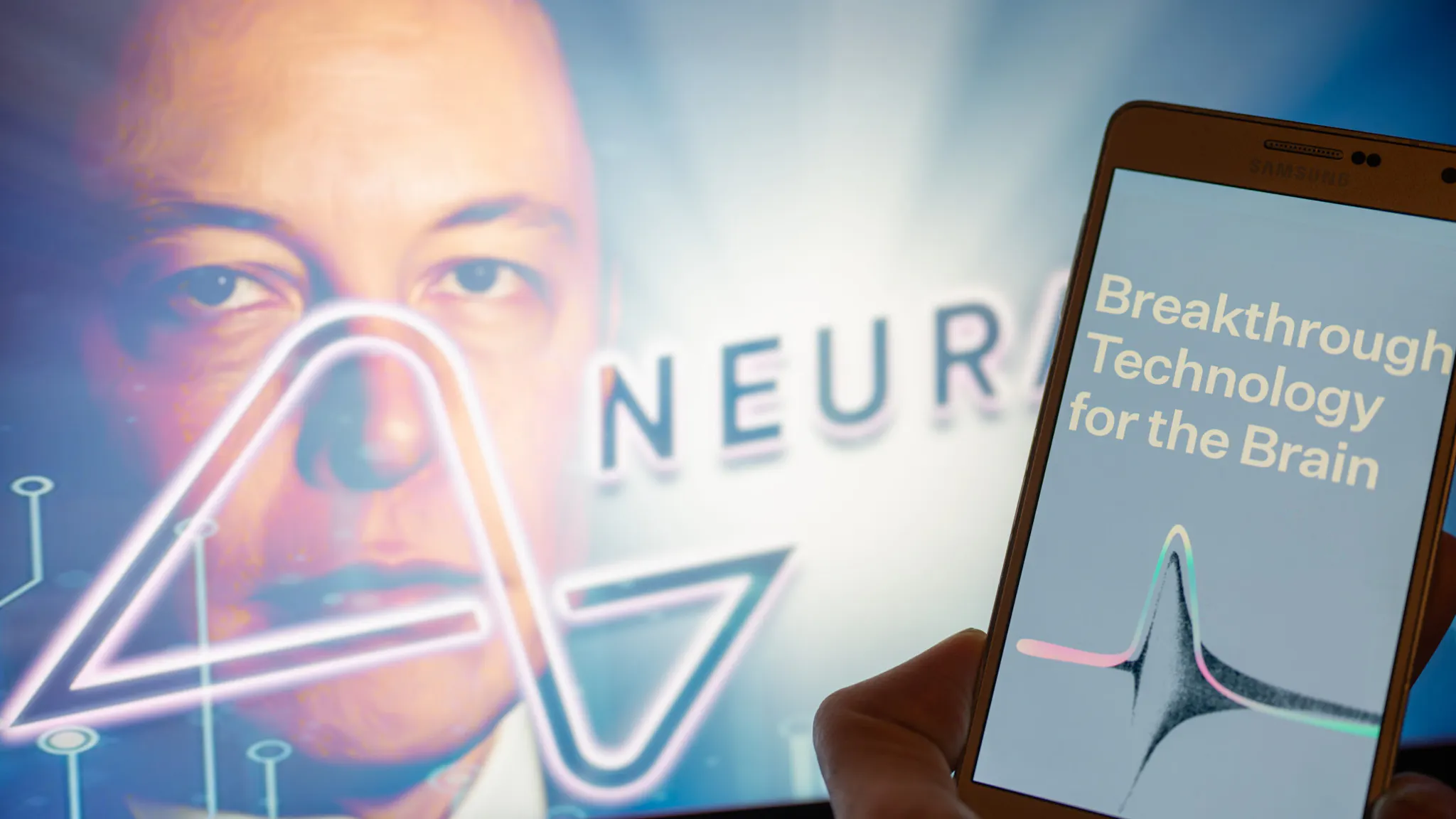 Elon Musk’s Neuralink Startup Receives FDA Approval For First In-Human ...